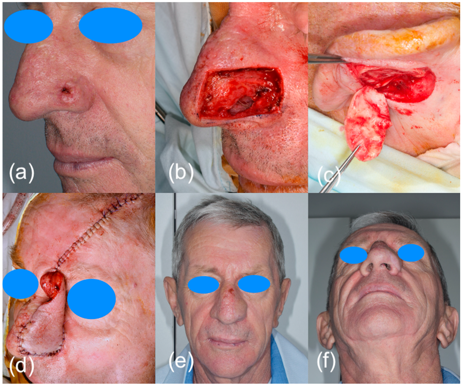 Diagnostics 13 01002 g002