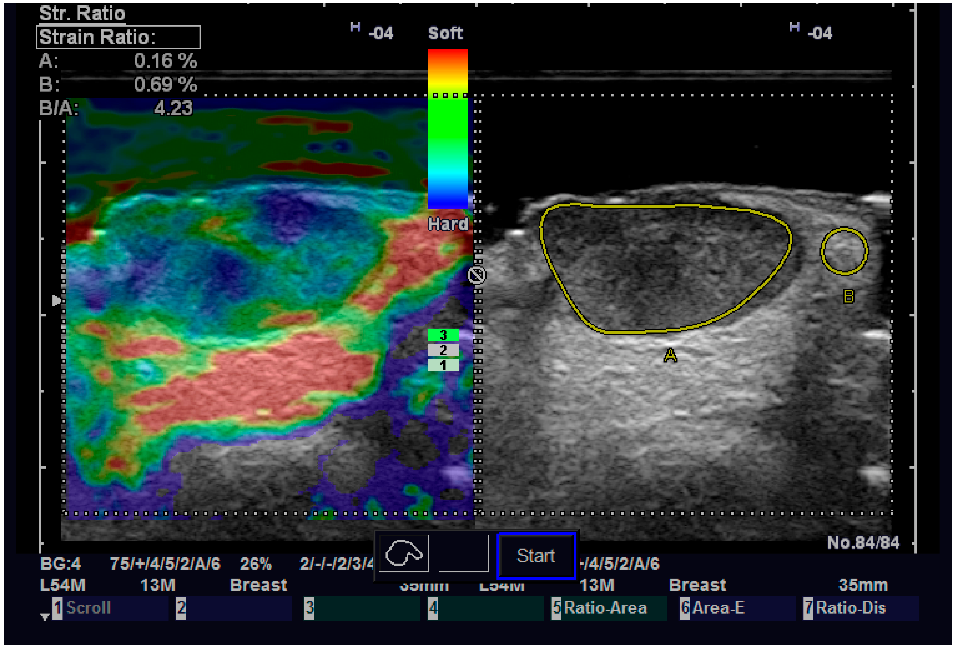 Diagnostics 13 01002 g006