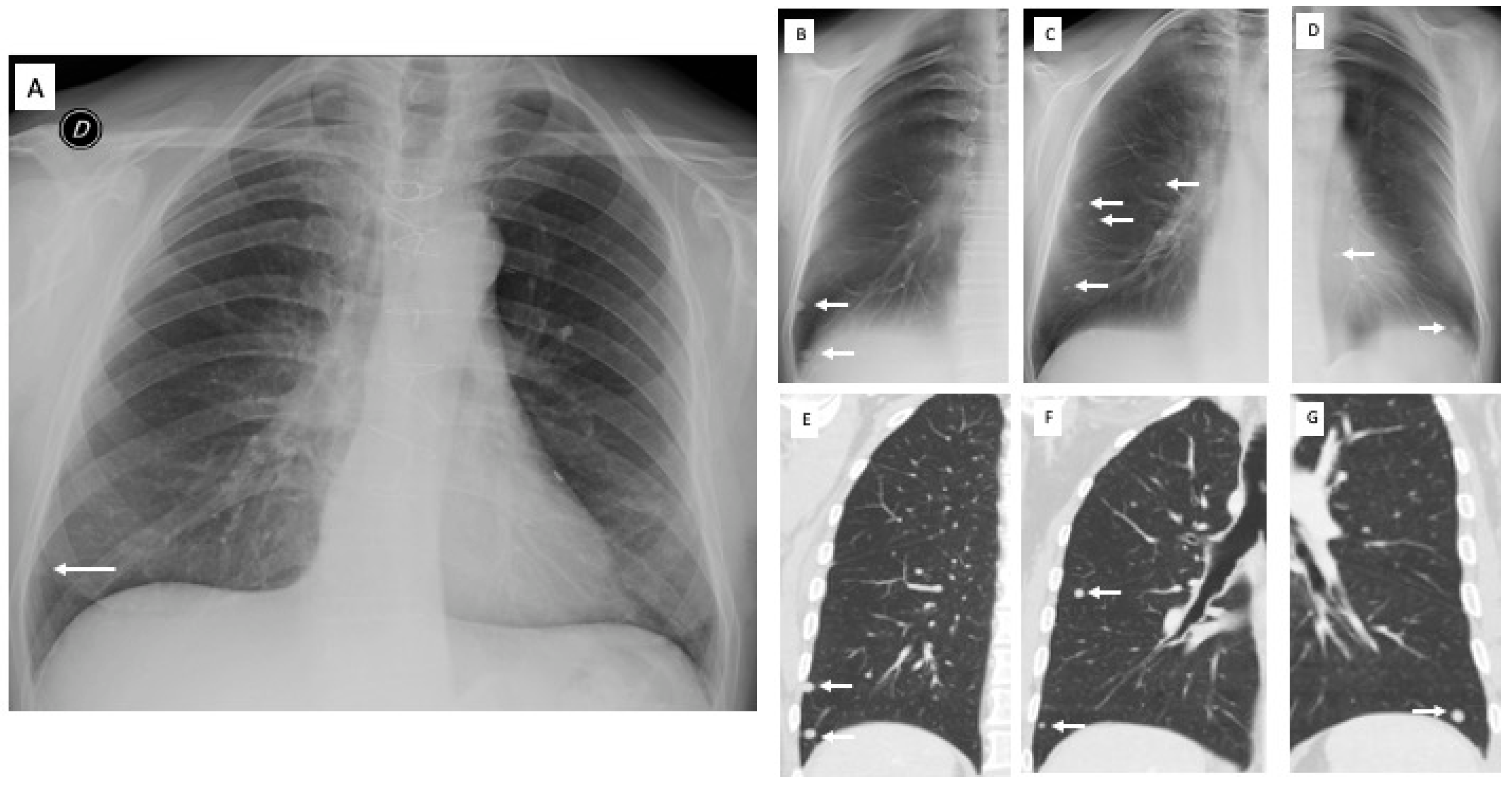 Diagnostics 13 01010 g002