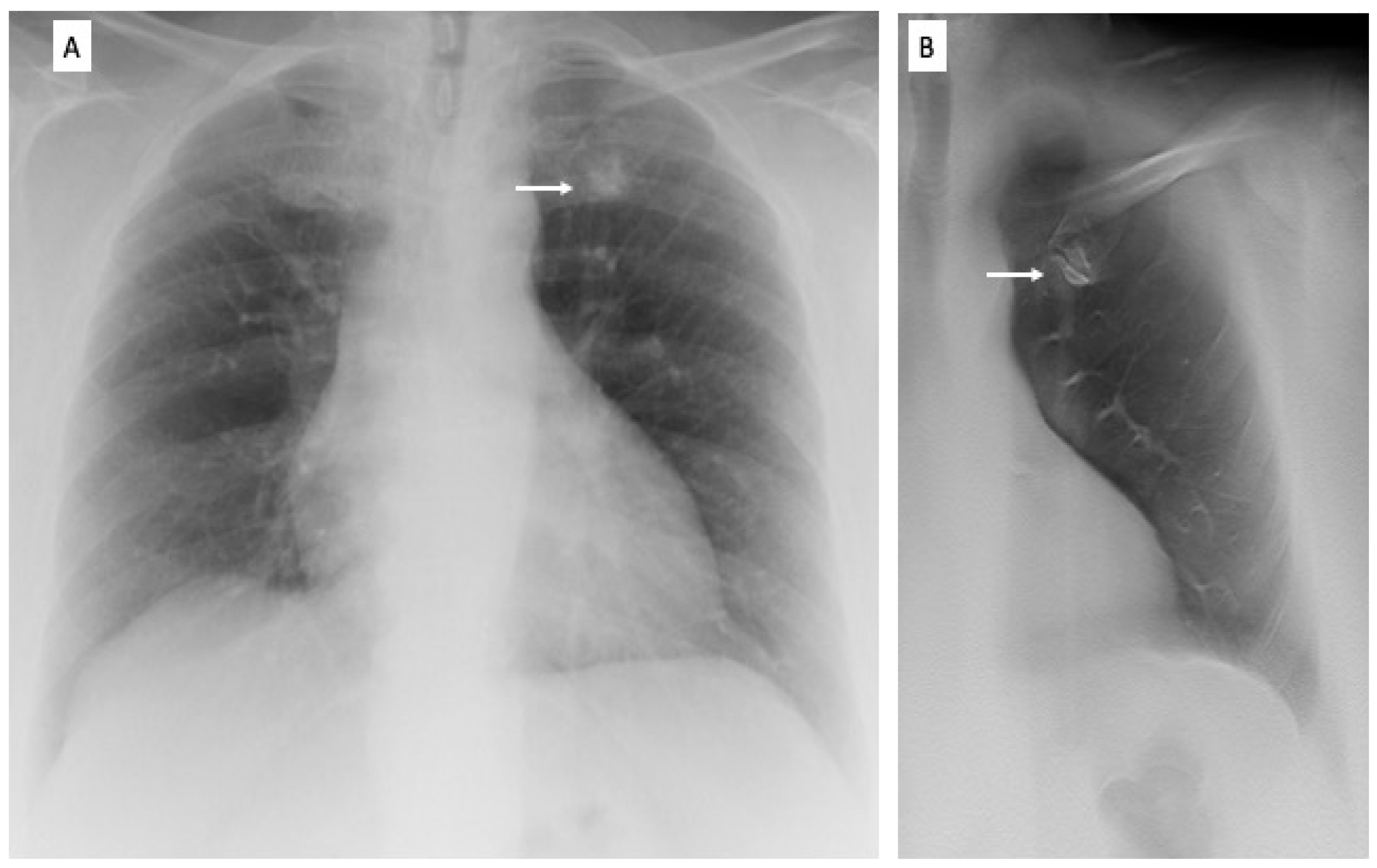 Diagnostics 13 01010 g003