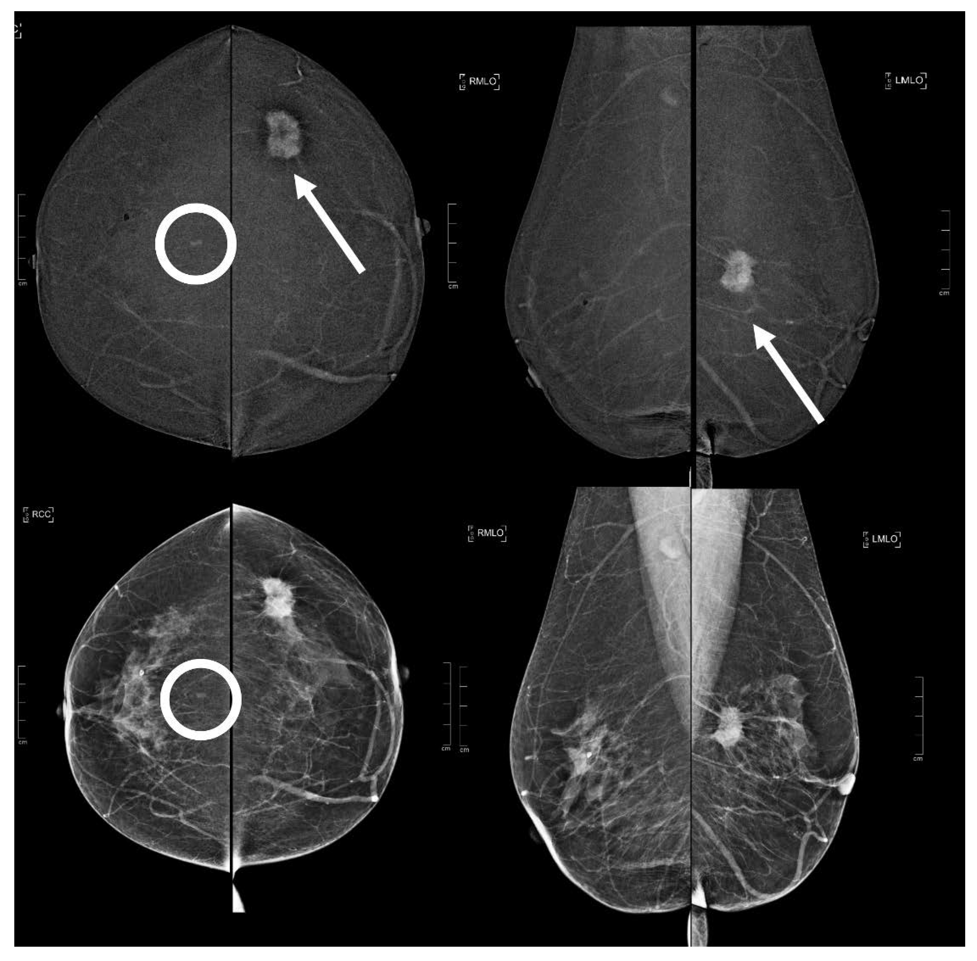 Diagnostics 13 01011 g004