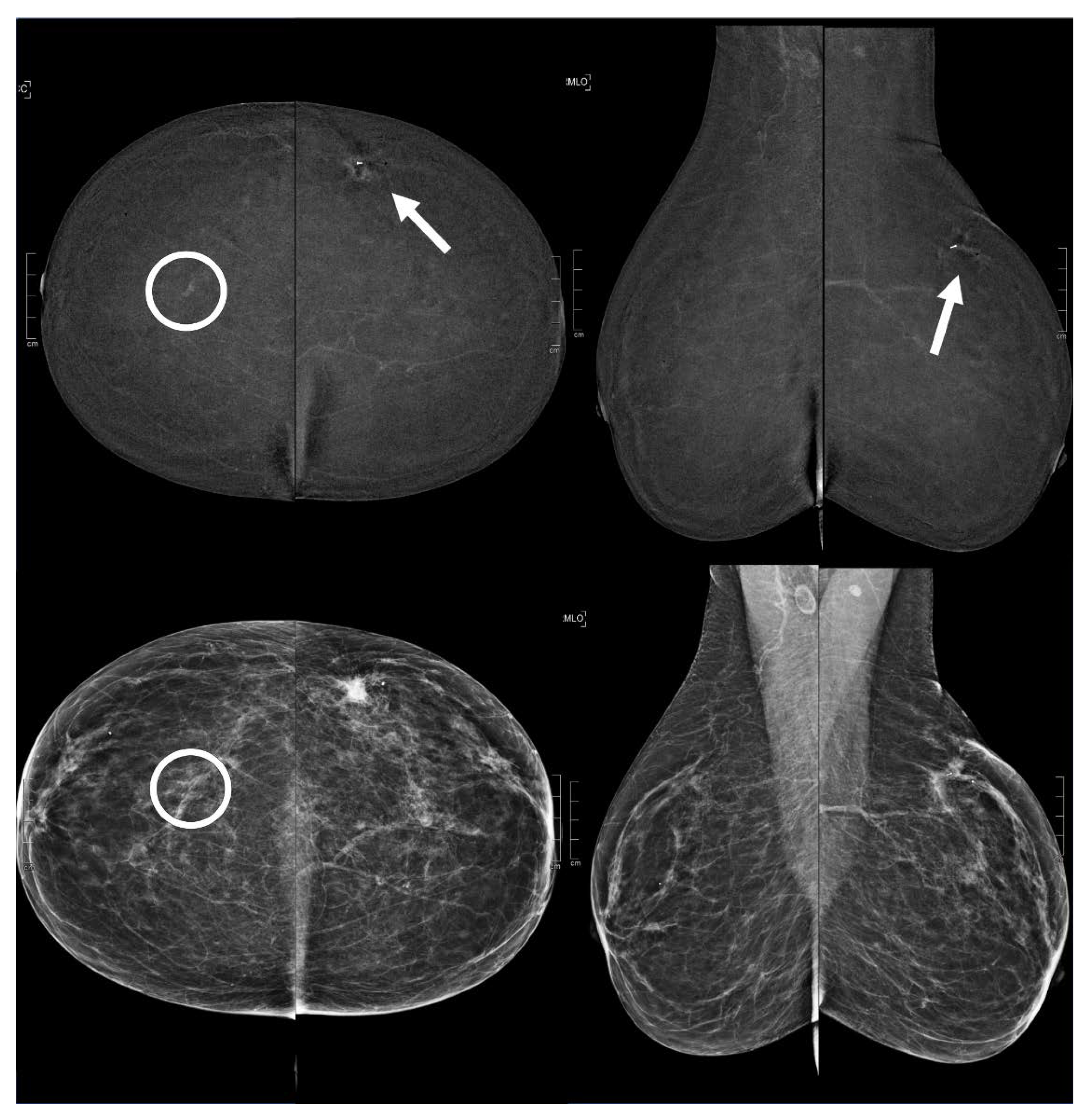Diagnostics 13 01011 g006