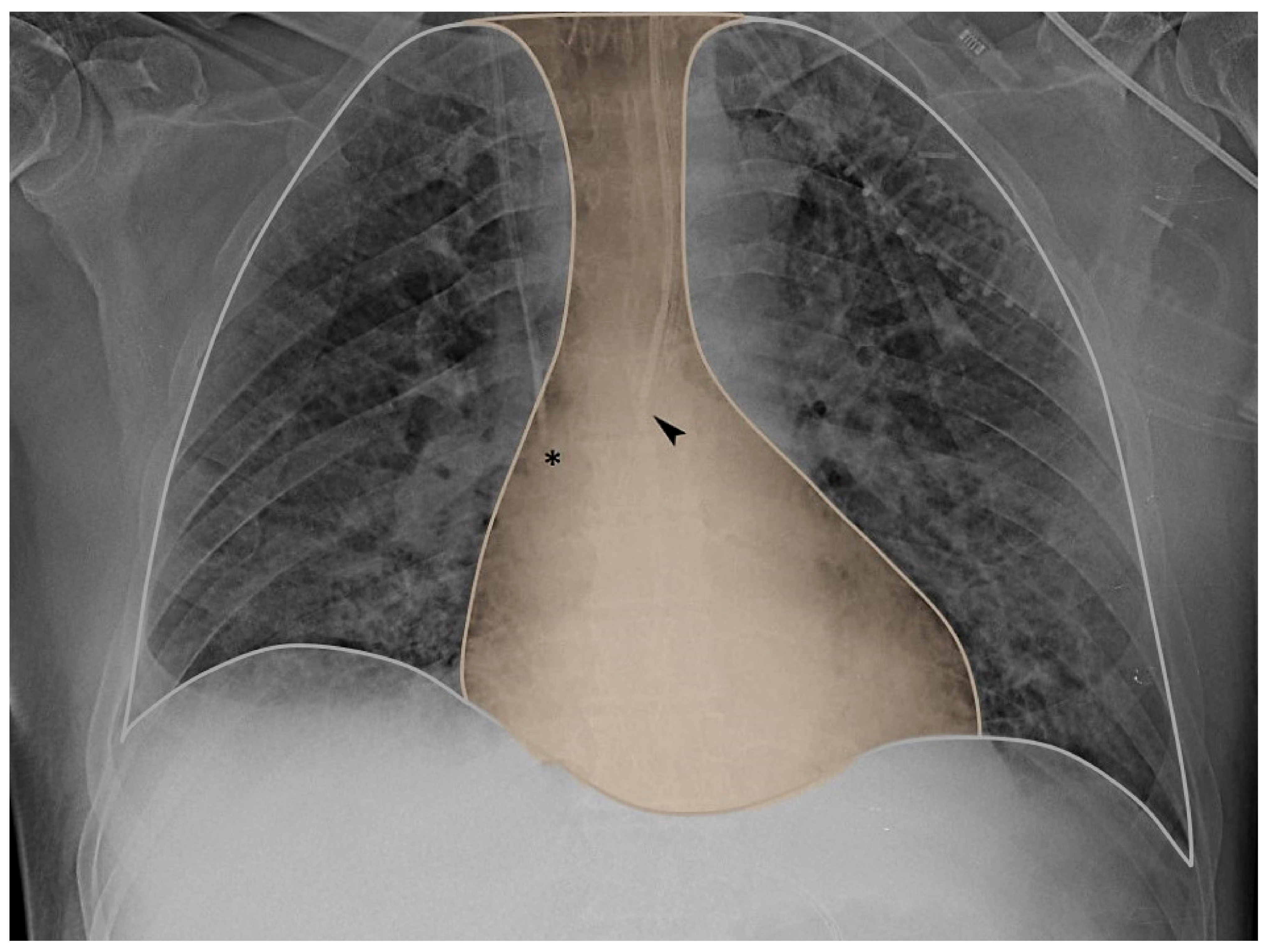 Diagnostics 13 01022 g001