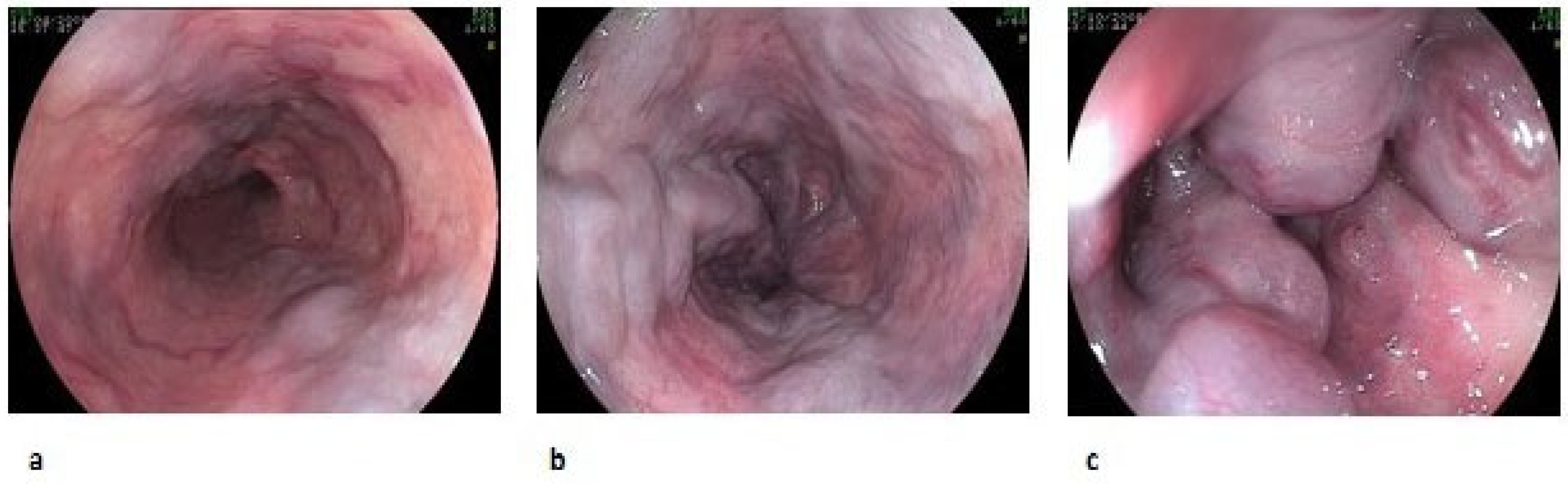 Diagnostics 13 01031 g001