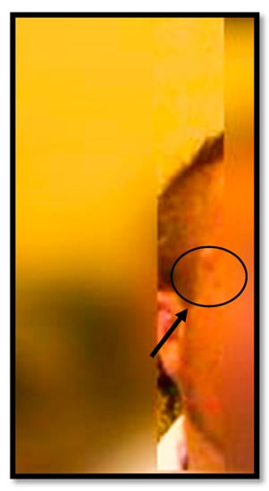 Diagnostics 13 01033 g001