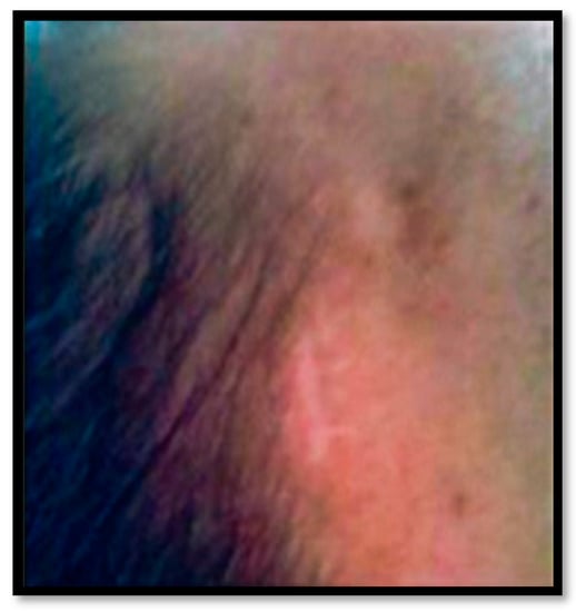 Diagnostics 13 01033 g003