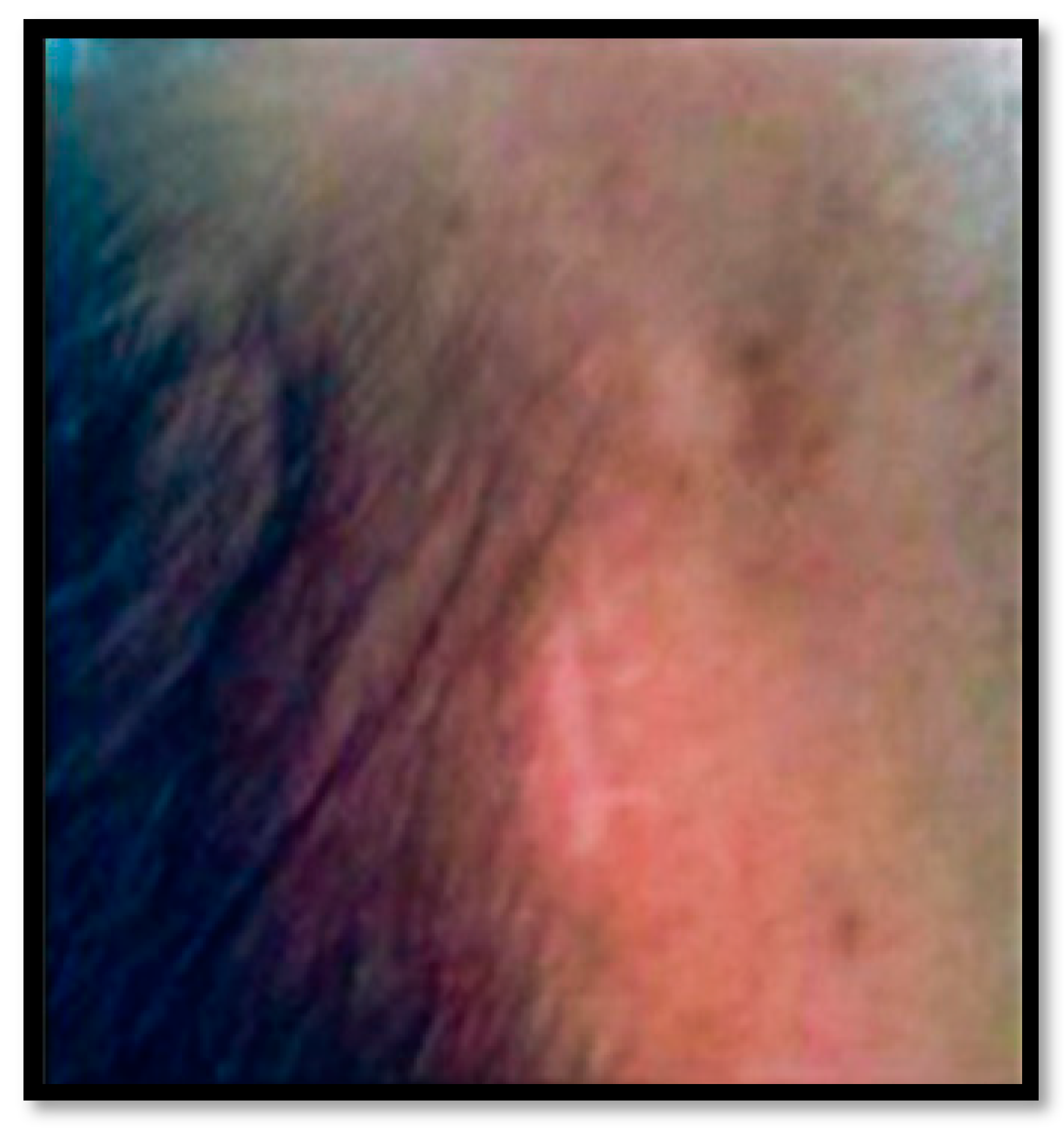 Diagnostics 13 01033 g003