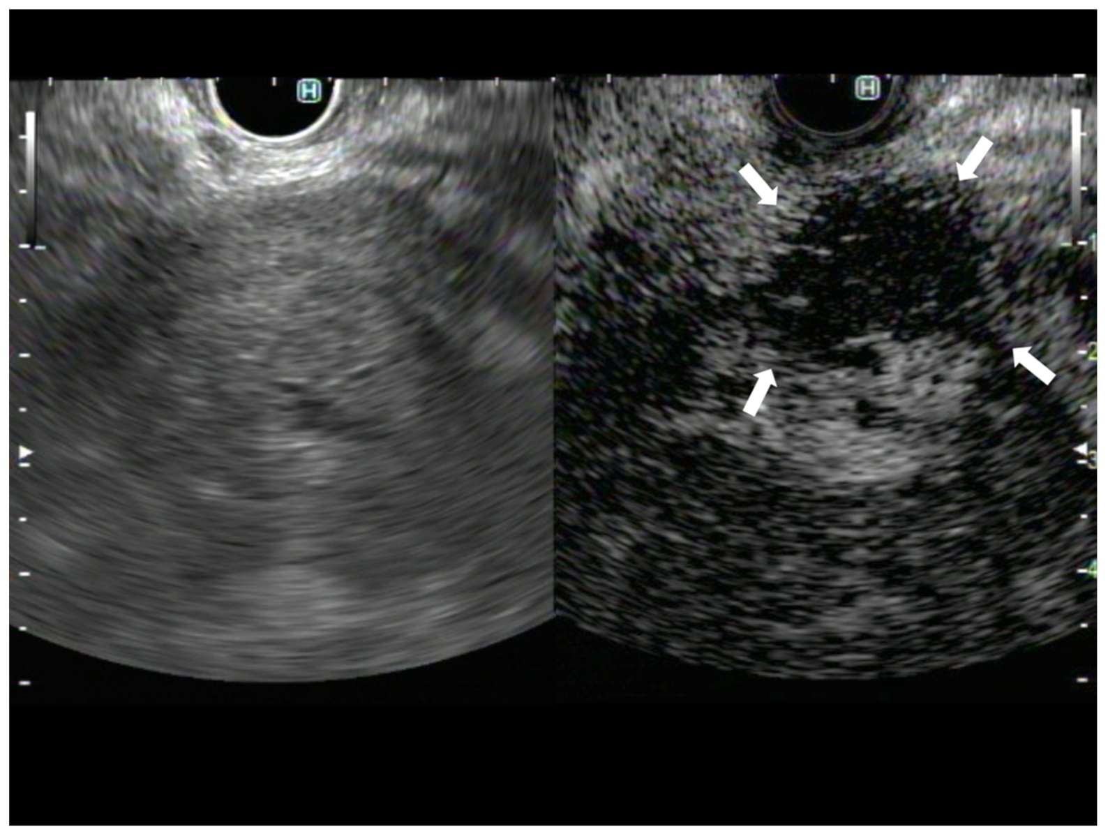 Diagnostics 13 01039 g002