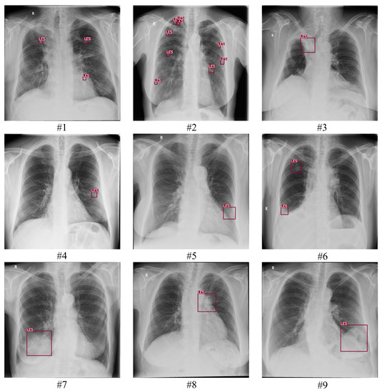 Diagnostics 13 01043 g0a1