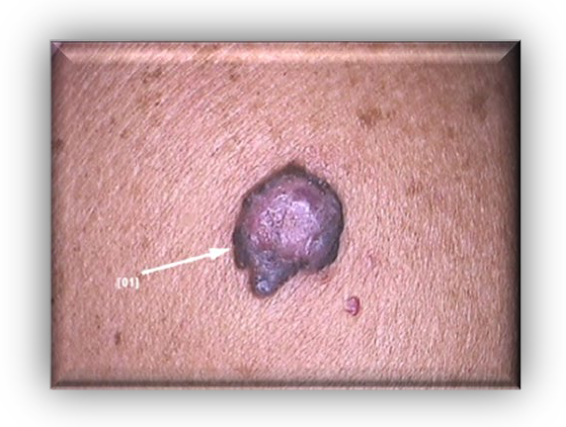 Diagnostics 13 01046 g001