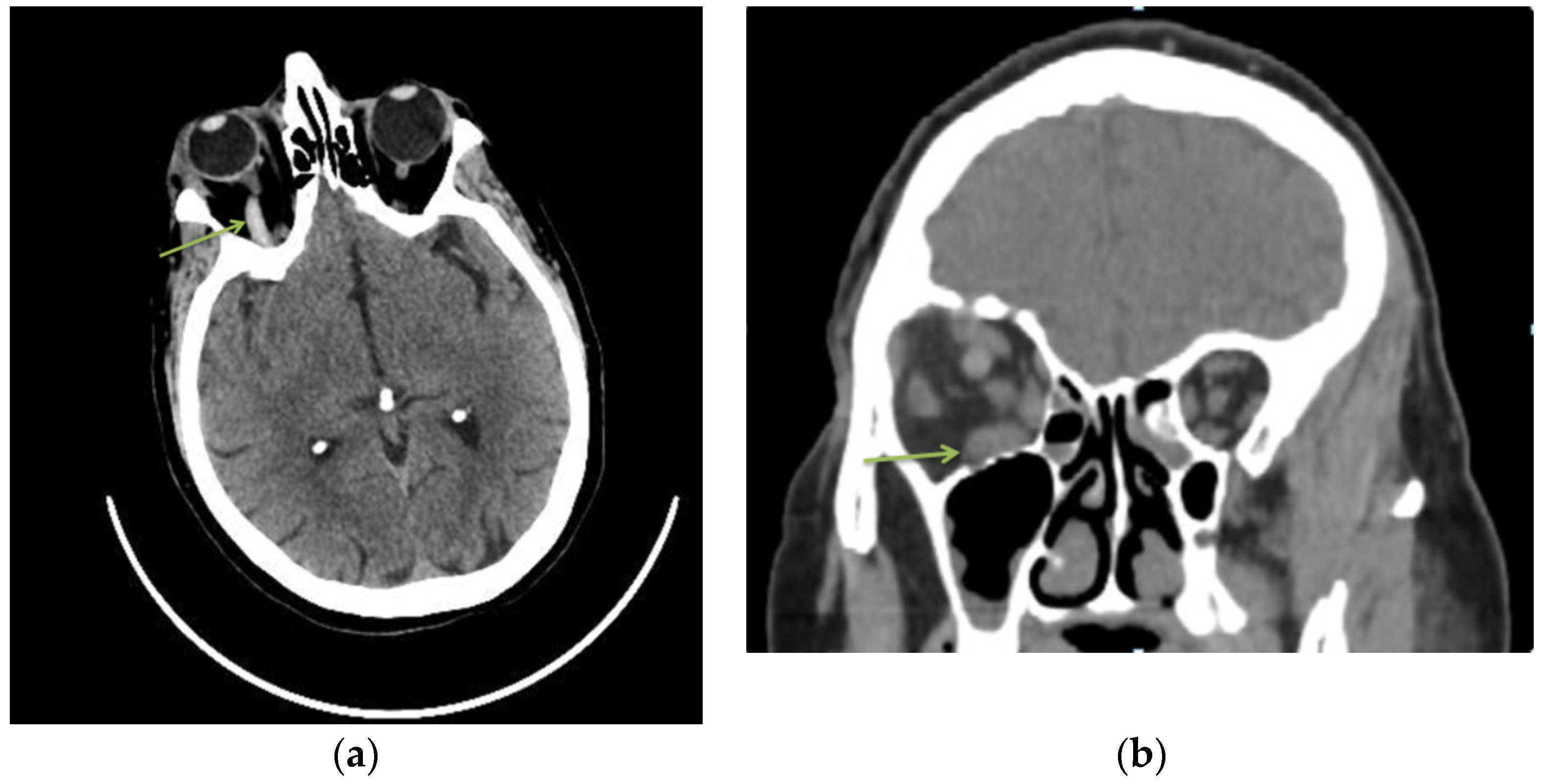 Diagnostics 13 01052 g001