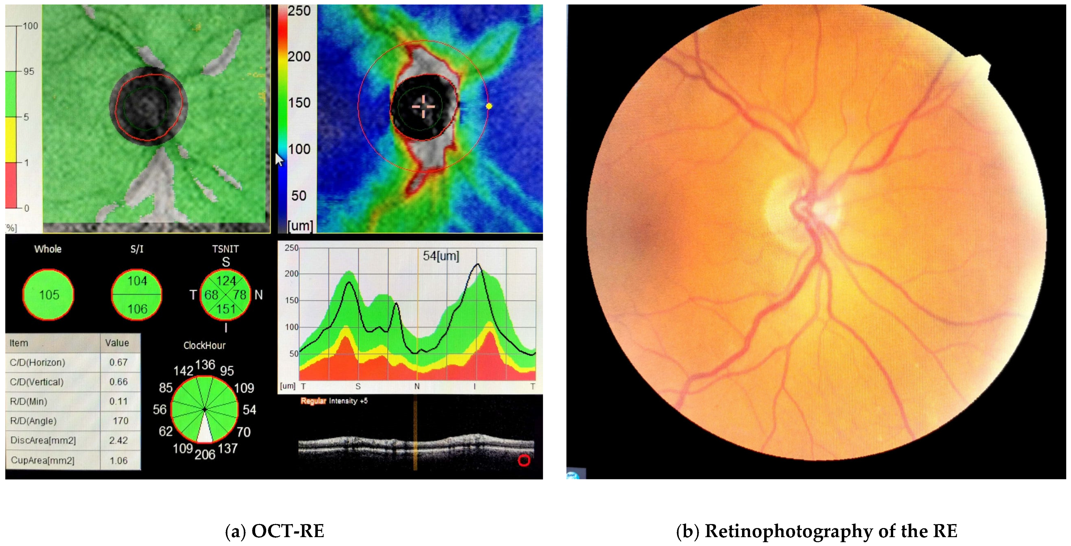 Diagnostics 13 01052 g002