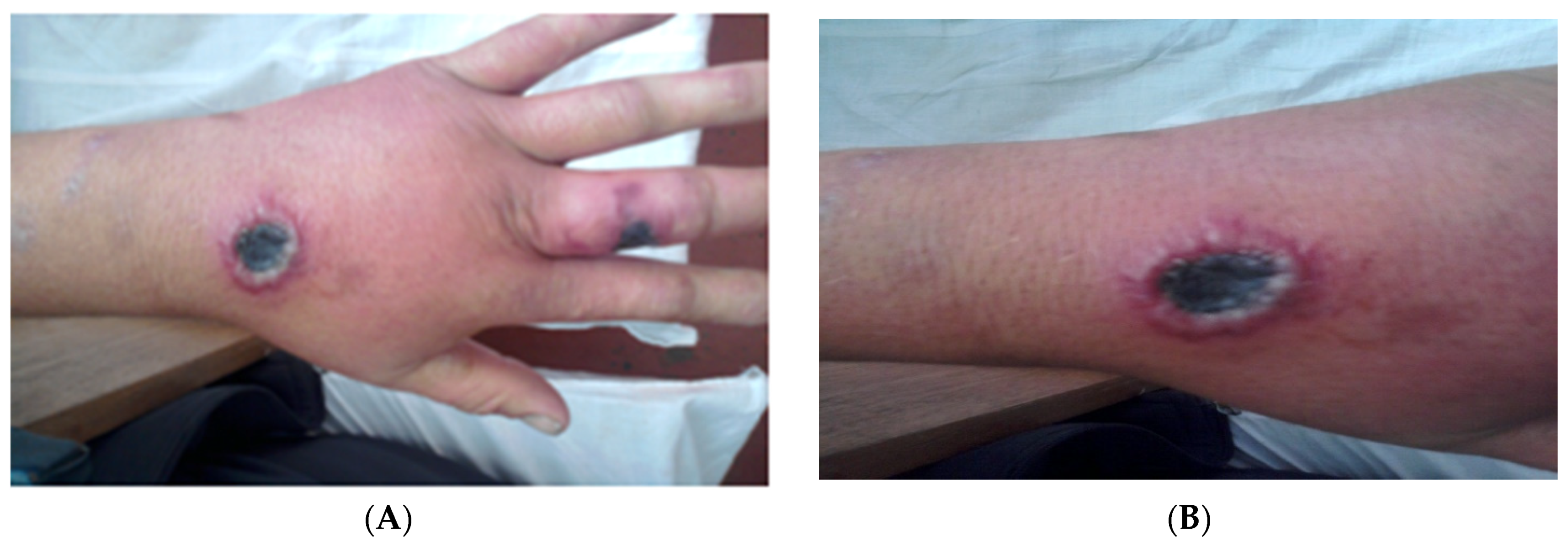 Diagnostics 13 01056 g002