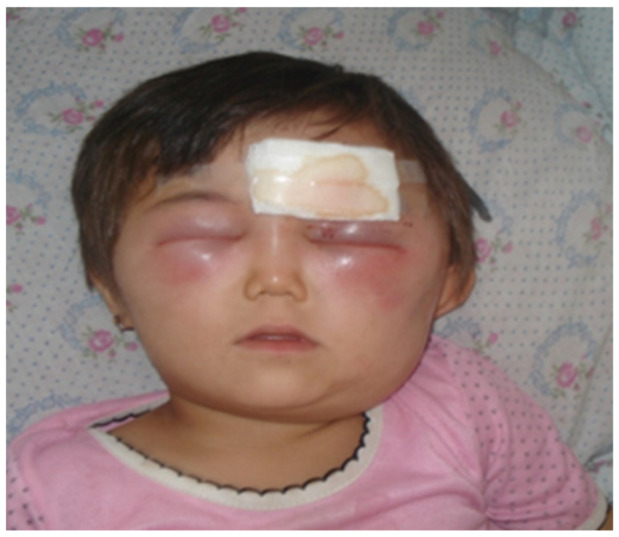 Diagnostics 13 01056 g004