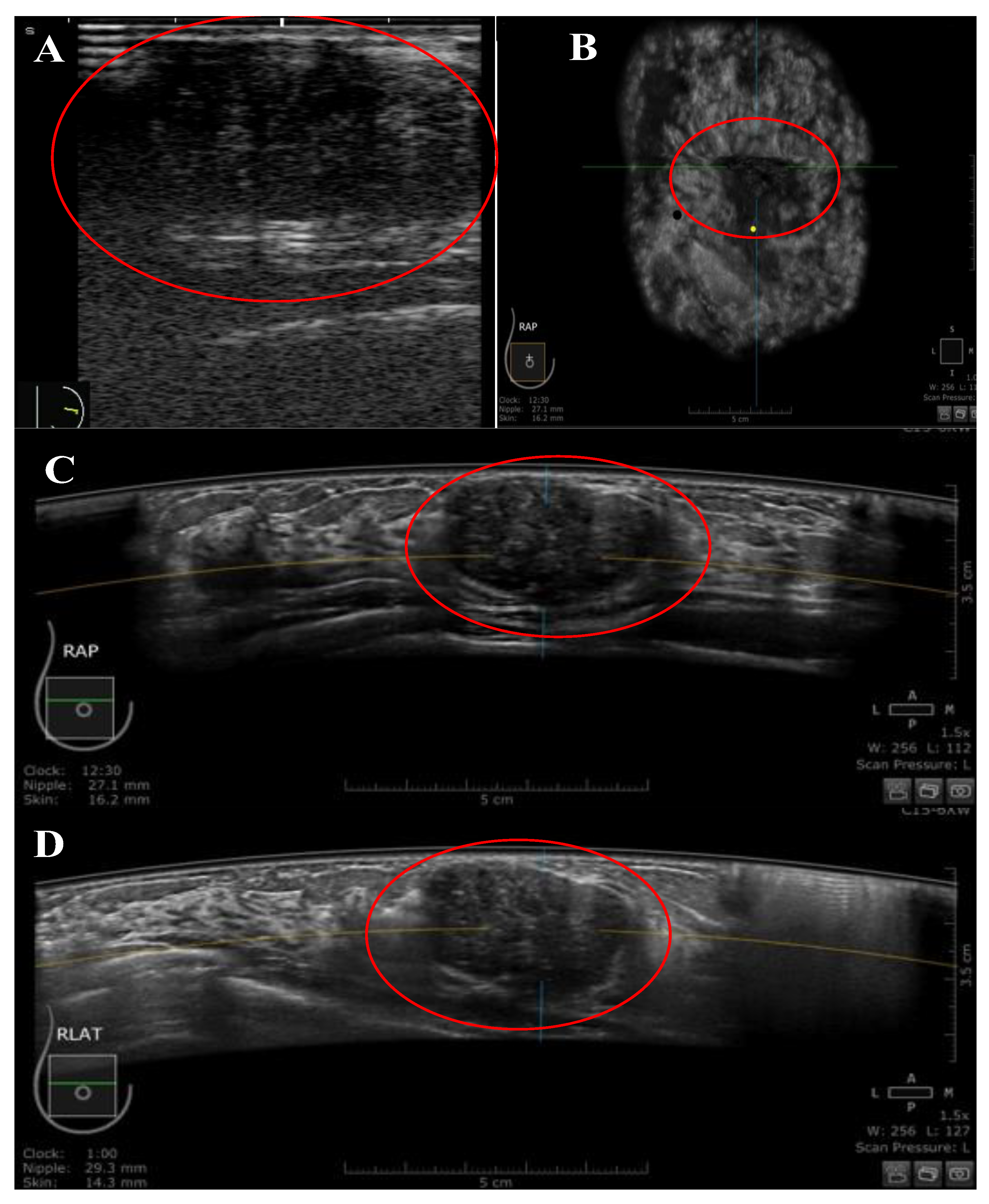 Diagnostics 13 01065 g003