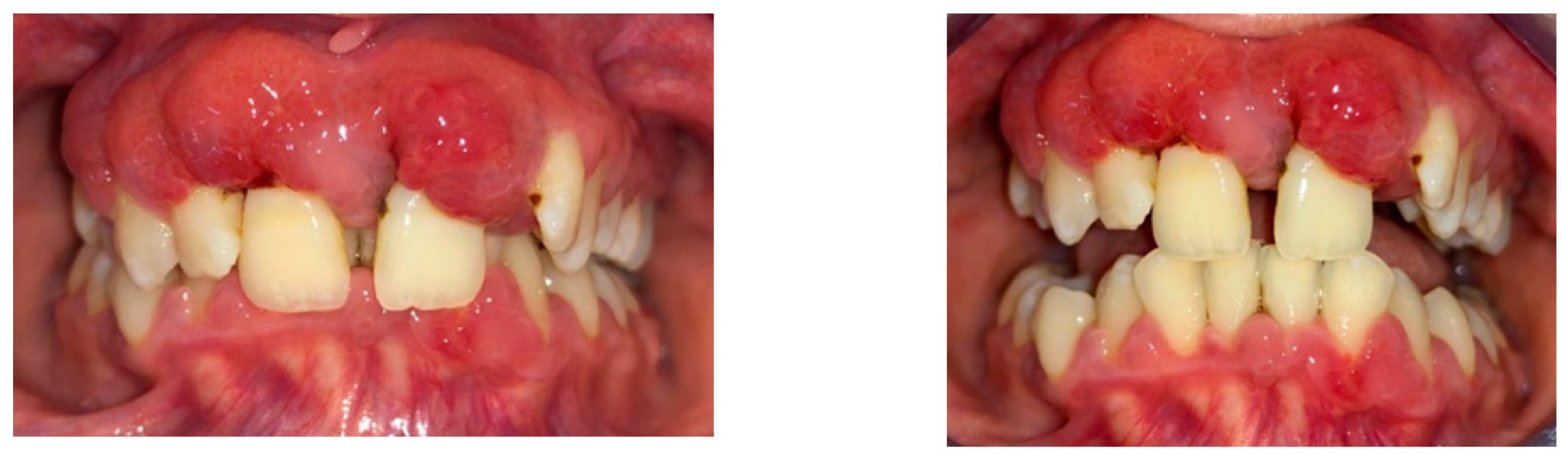 Diagnostics 13 01077 g004