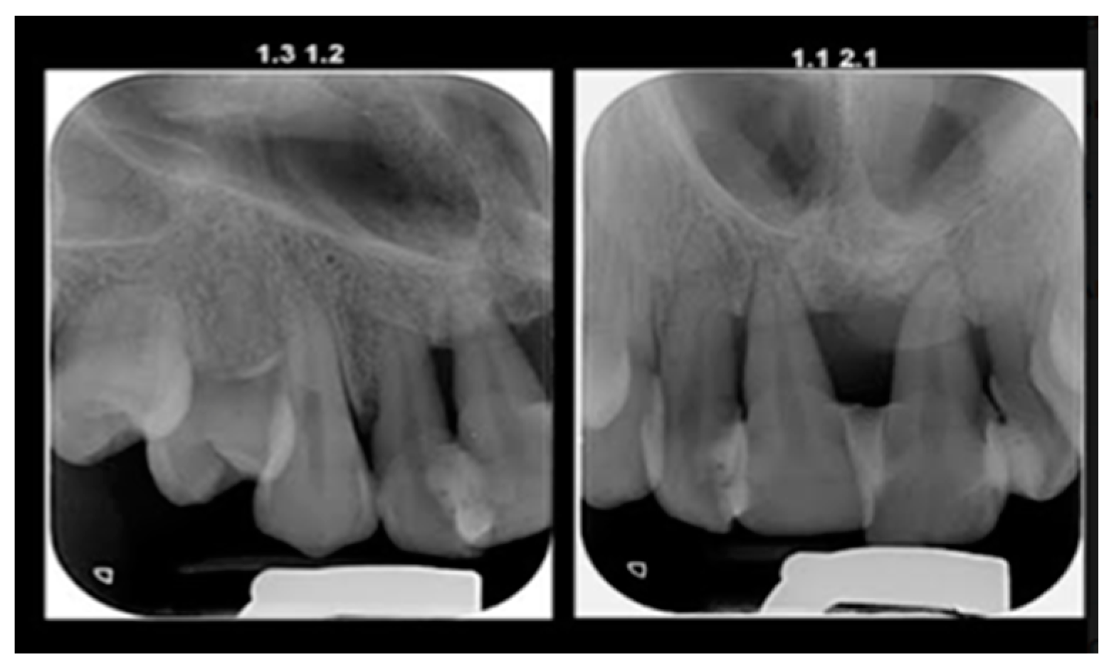 Diagnostics 13 01077 g007
