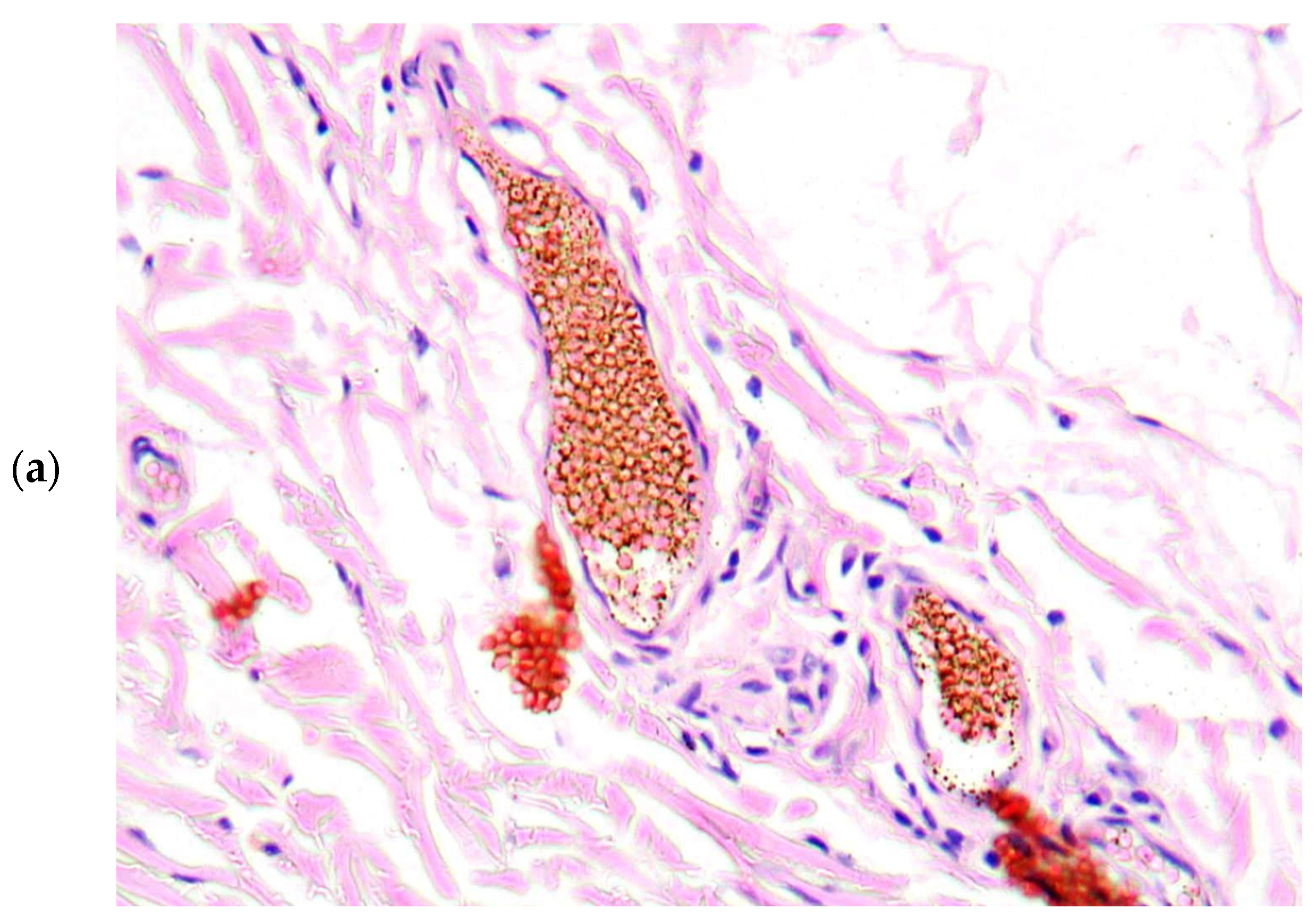 Diagnostics 13 01097 g004a