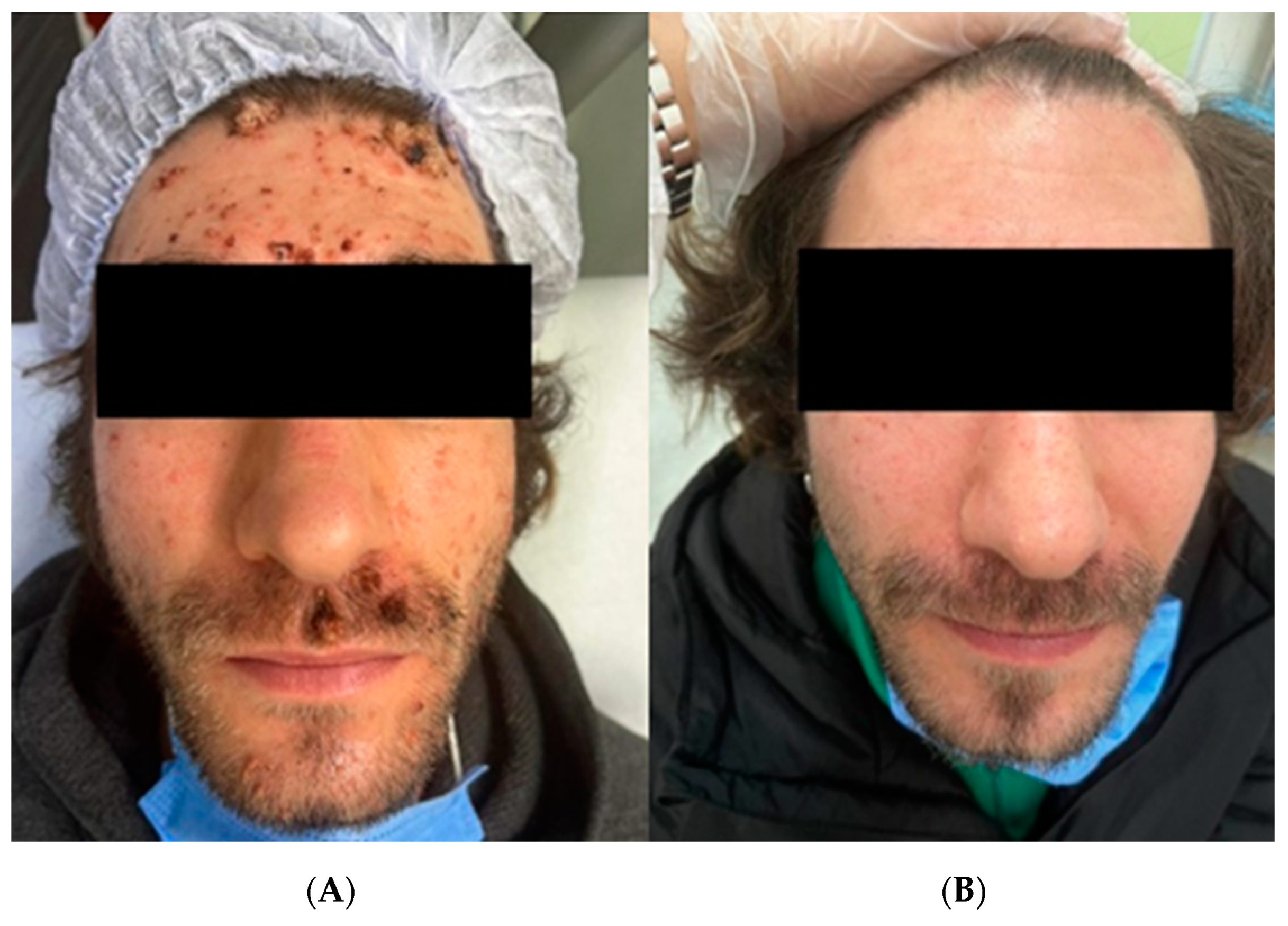 Diagnostics 13 01098 g001