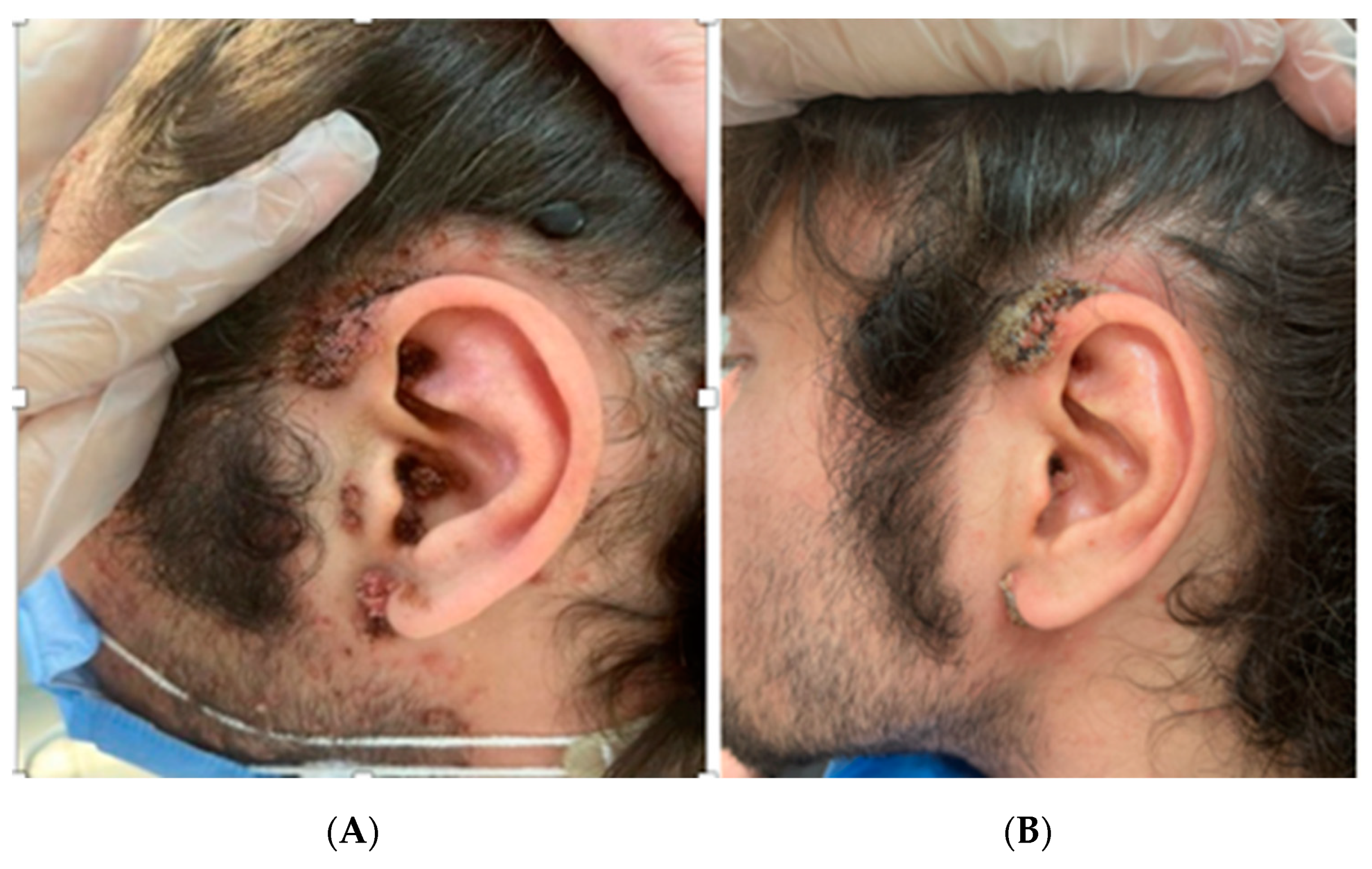 Diagnostics 13 01098 g002