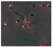 Diagnostics 13 01100 i012