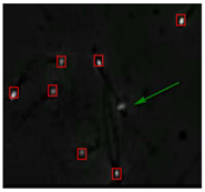 Diagnostics 13 01100 i014