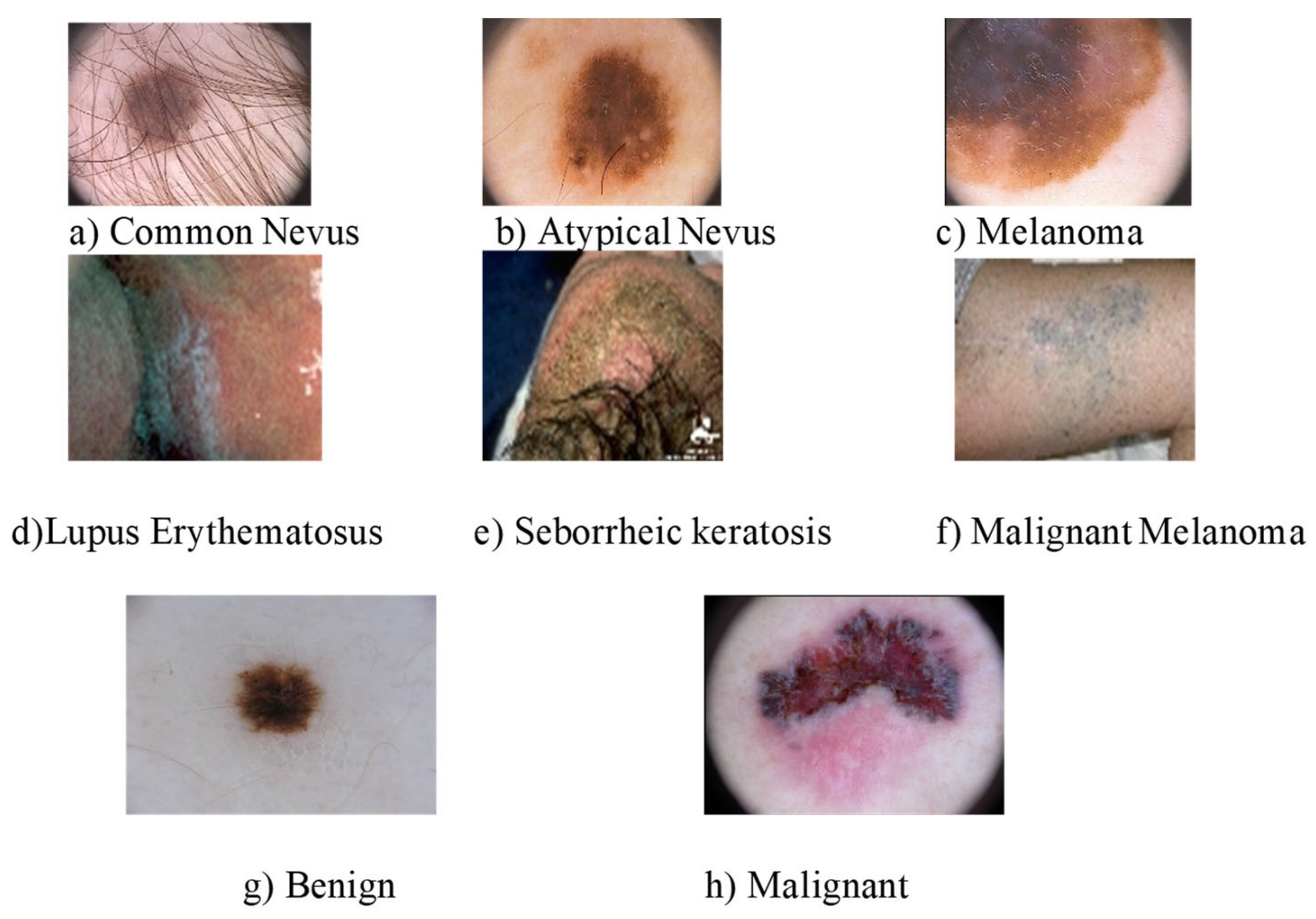 Diagnostics 13 01104 g001