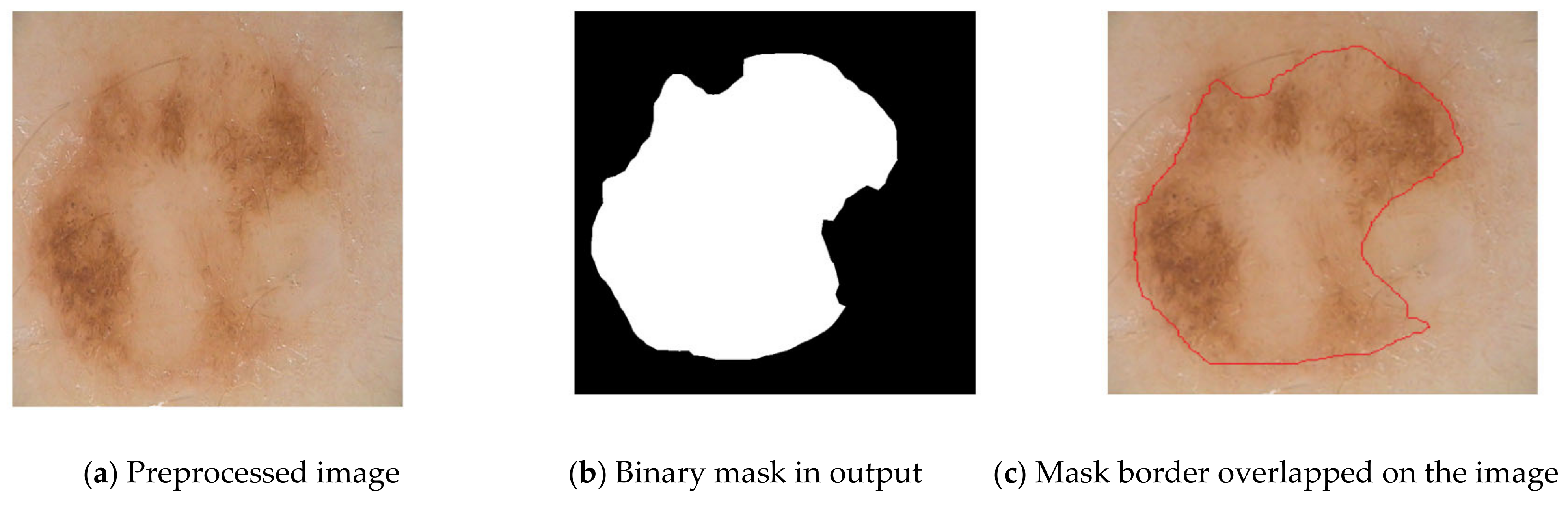 Diagnostics 13 01104 g004