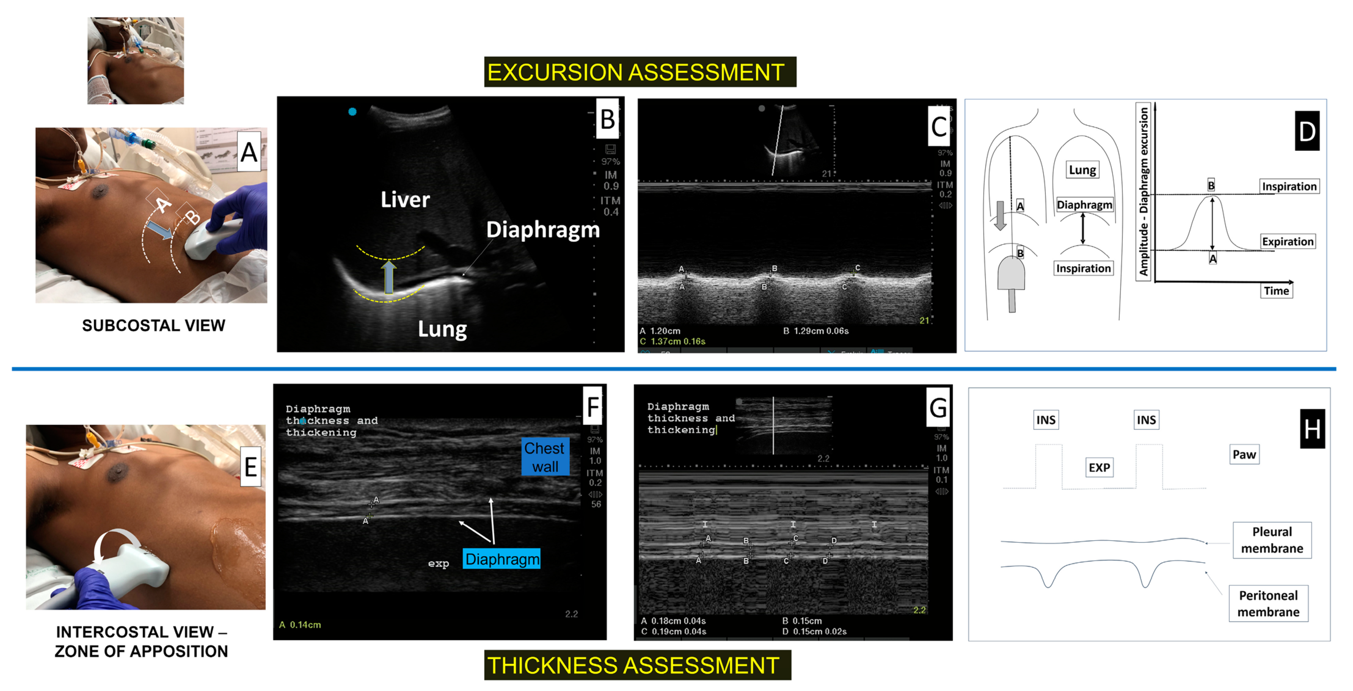 Diagnostics 13 01116 g002 Diagnostics 13 01116 g002