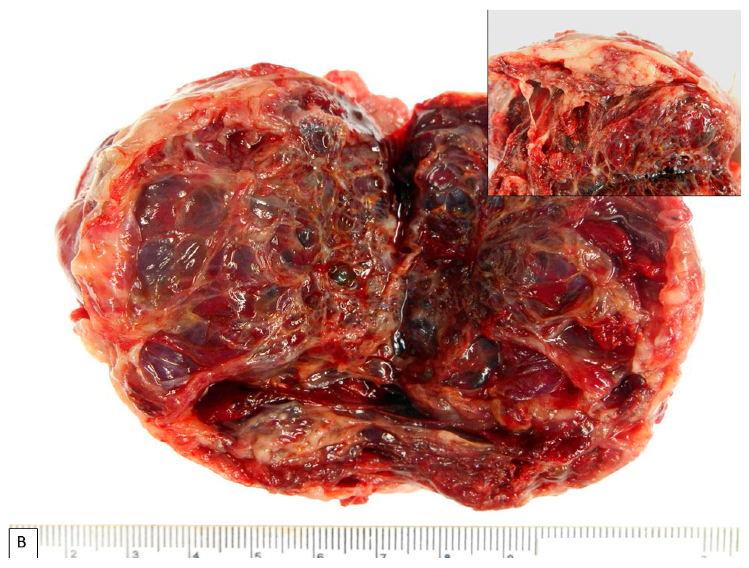 Diagnostics 13 01119 g001b