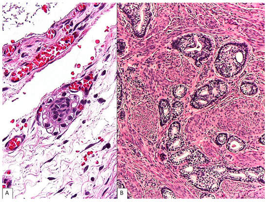 Diagnostics 13 01119 g004
