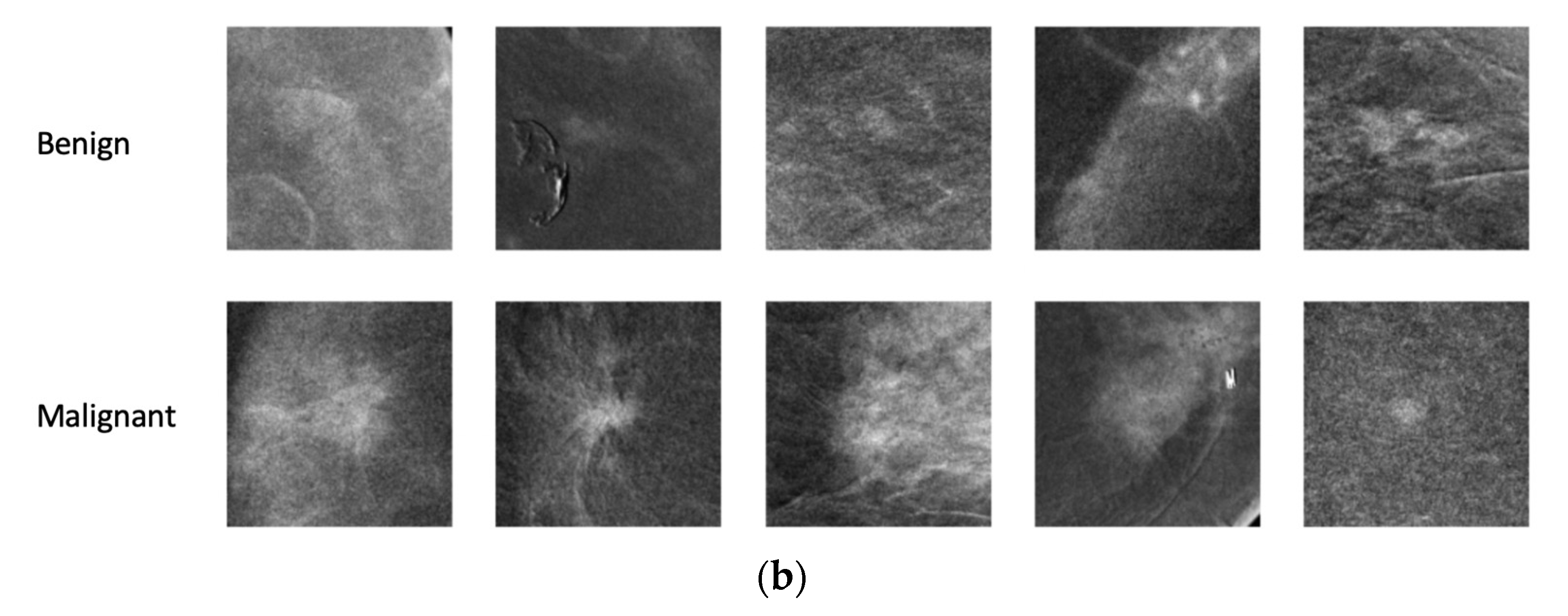 Diagnostics 13 01129 g002b