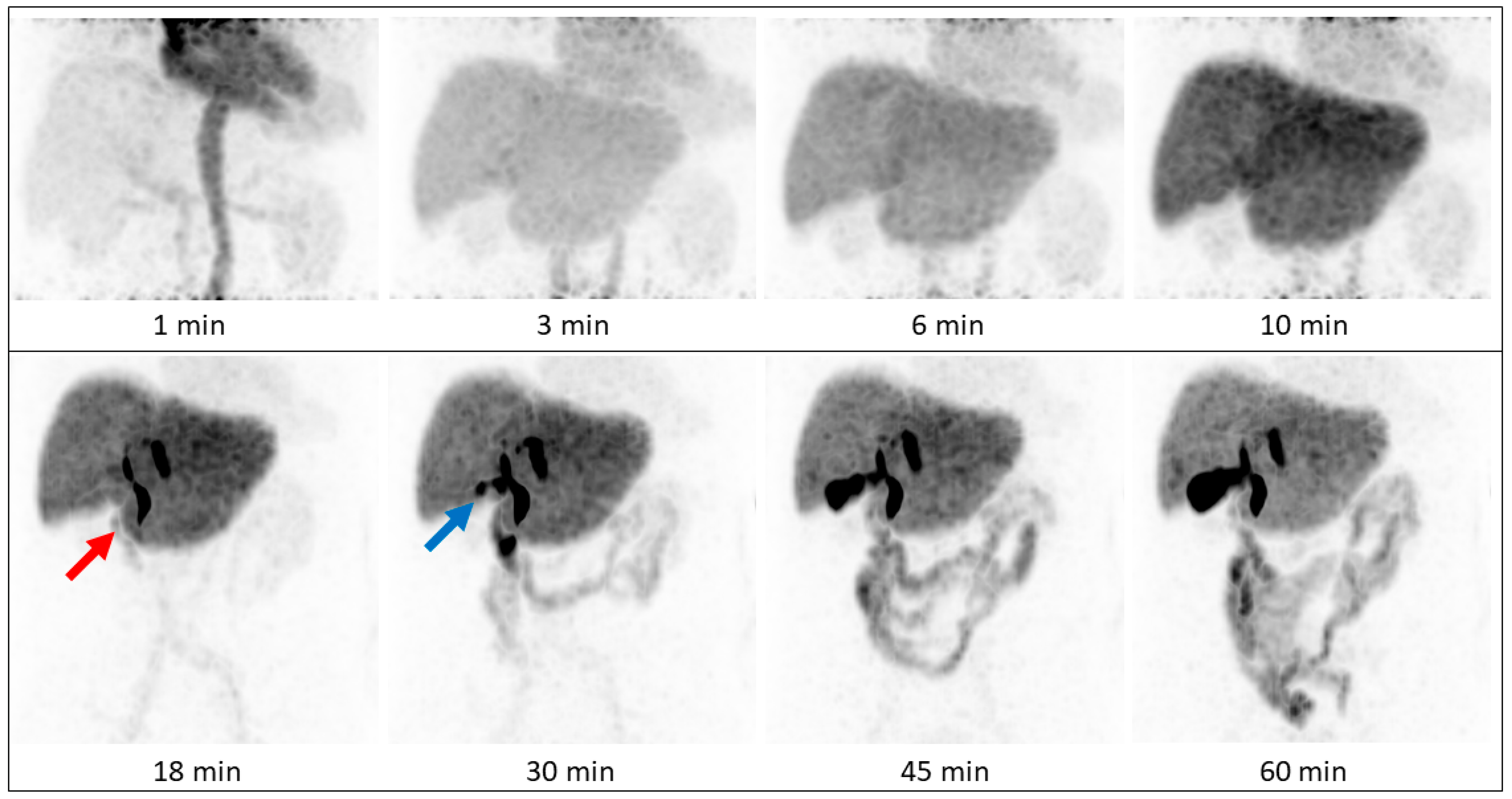 Diagnostics 13 01144 g004