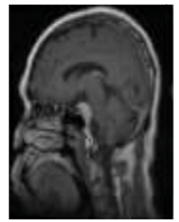 Diagnostics 13 01153 i006