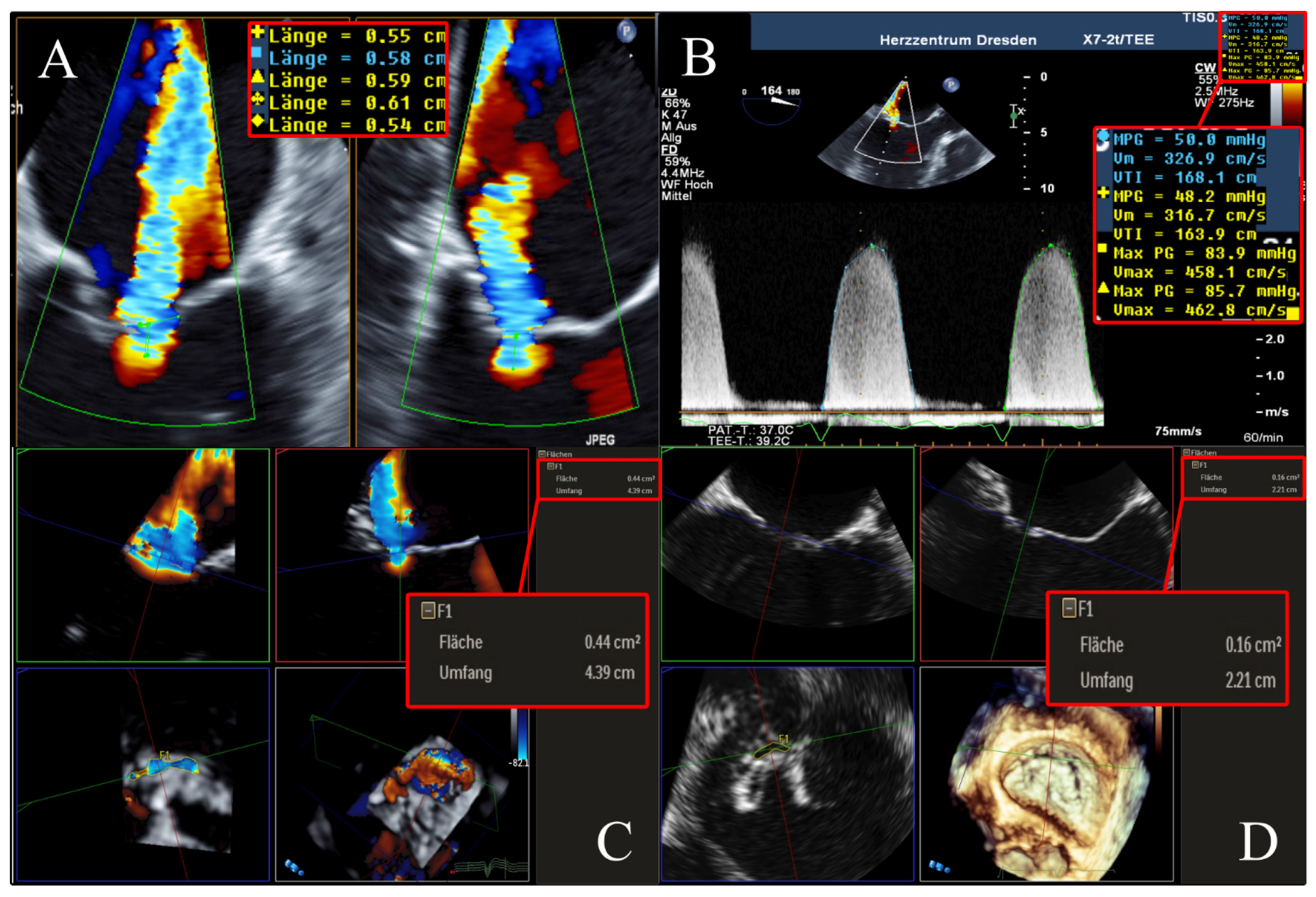 Diagnostics 13 01176 g005