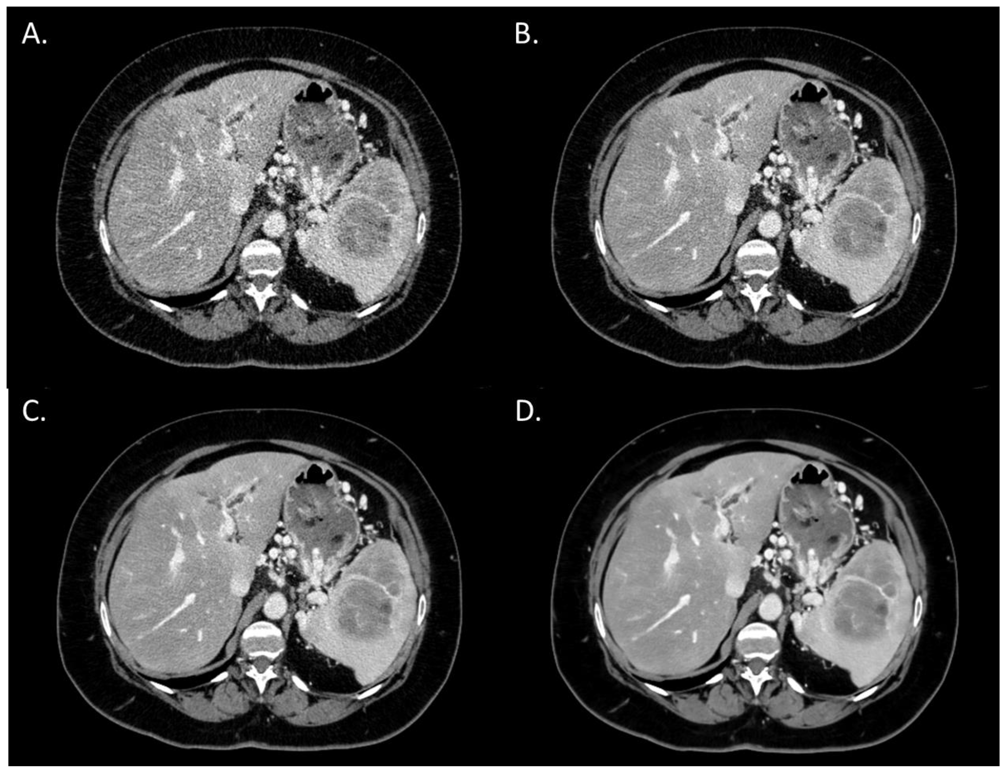 Diagnostics 13 01182 g001 Diagnostics 13 01182 g001