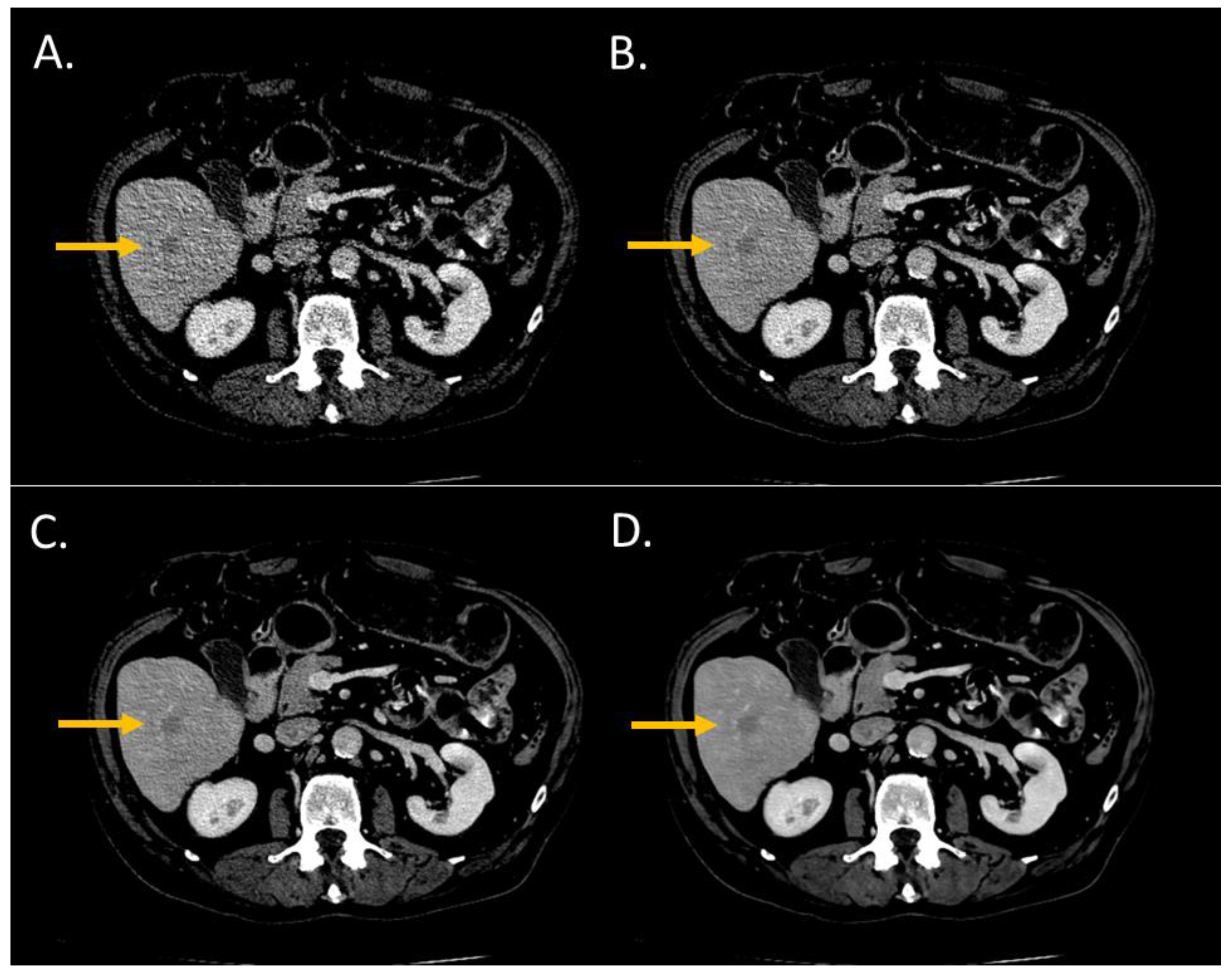 Diagnostics 13 01182 g002 Diagnostics 13 01182 g002