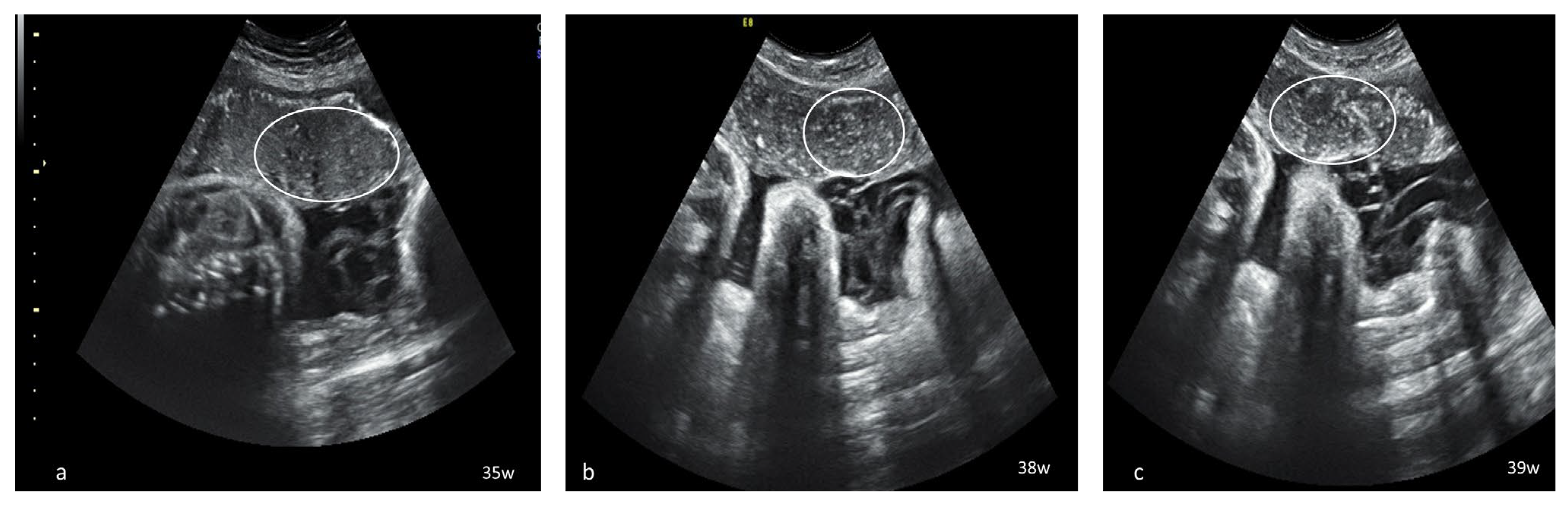 Diagnostics 13 01200 g001