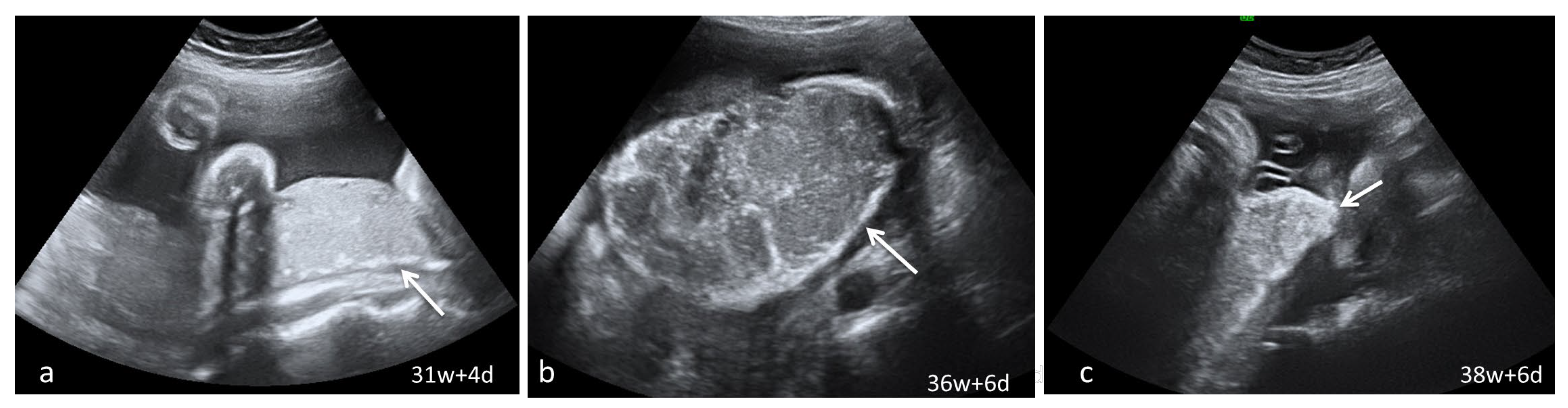 Diagnostics 13 01200 g002