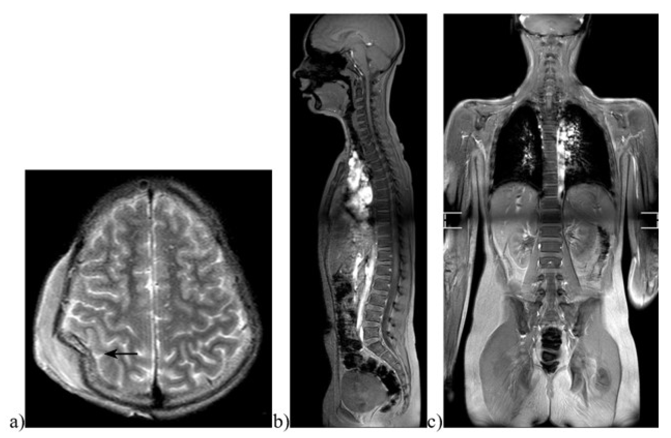 Diagnostics 13 01218 g002 Diagnostics 13 01218 g002