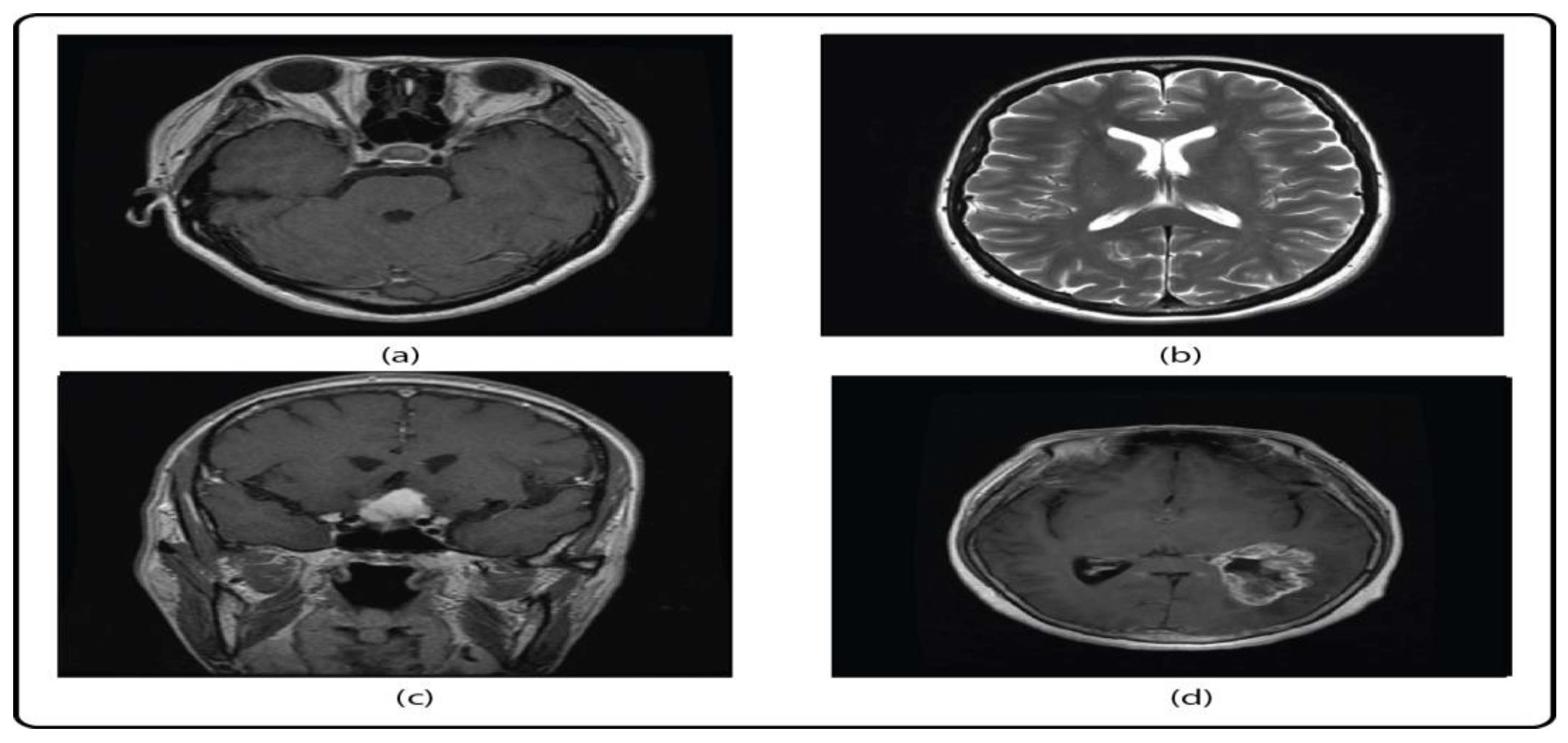 Diagnostics 13 01229 g005