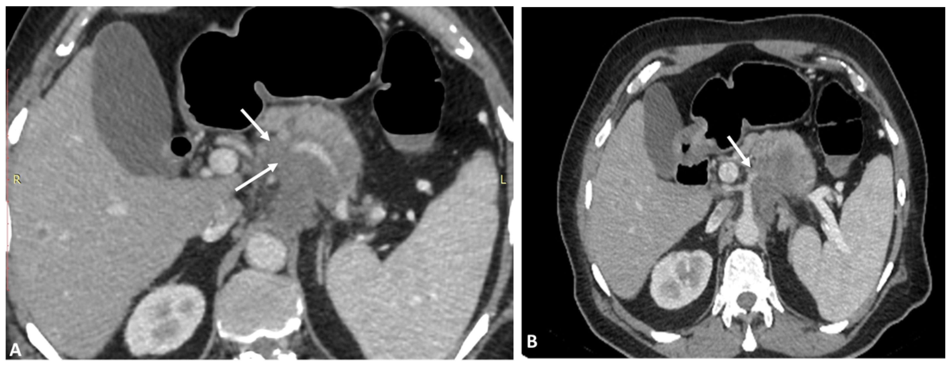 Diagnostics 13 01233 g007