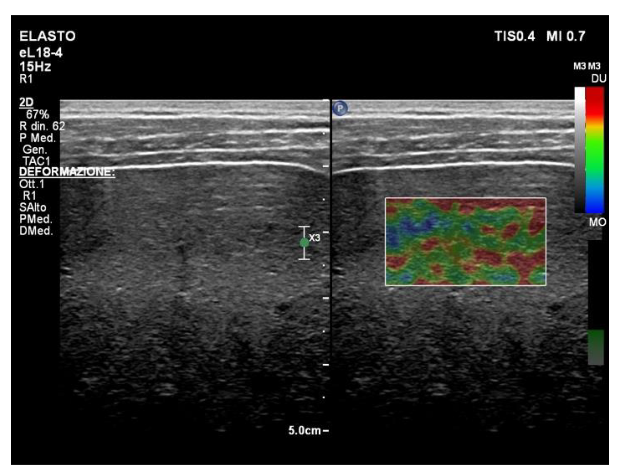 Diagnostics 13 01236 g003