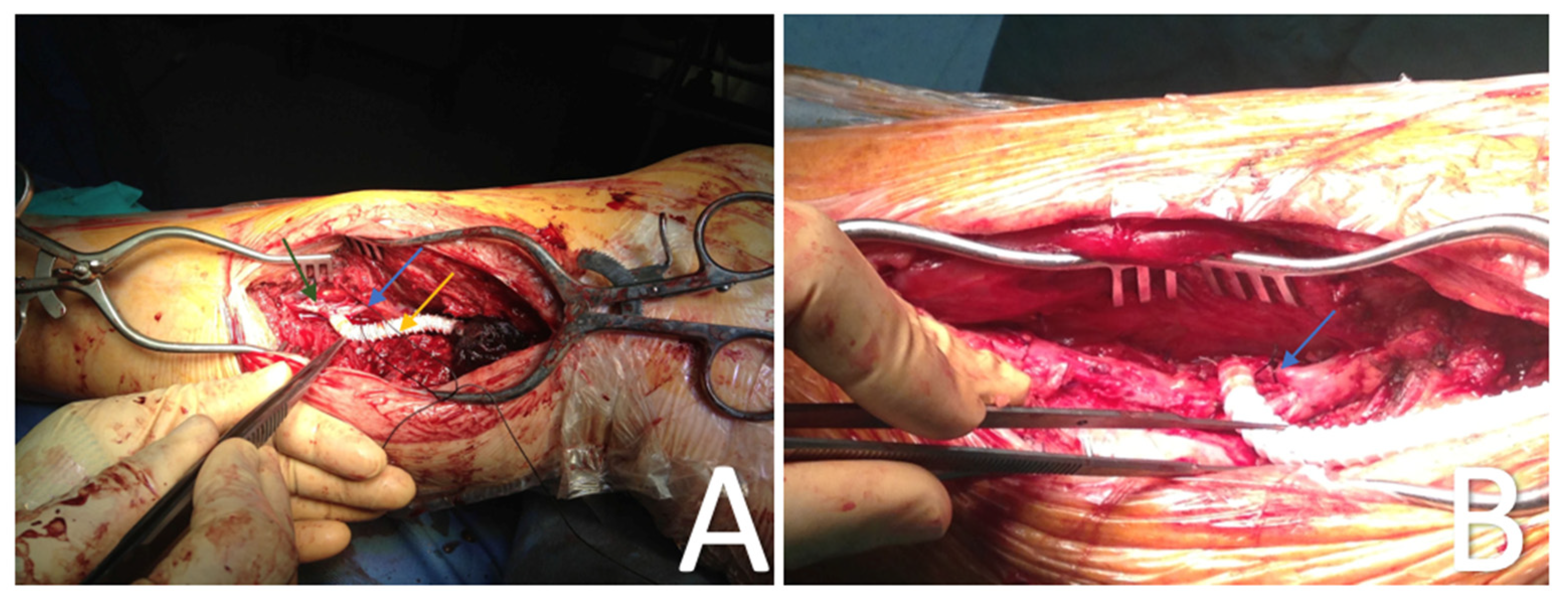 Diagnostics 13 01246 g002