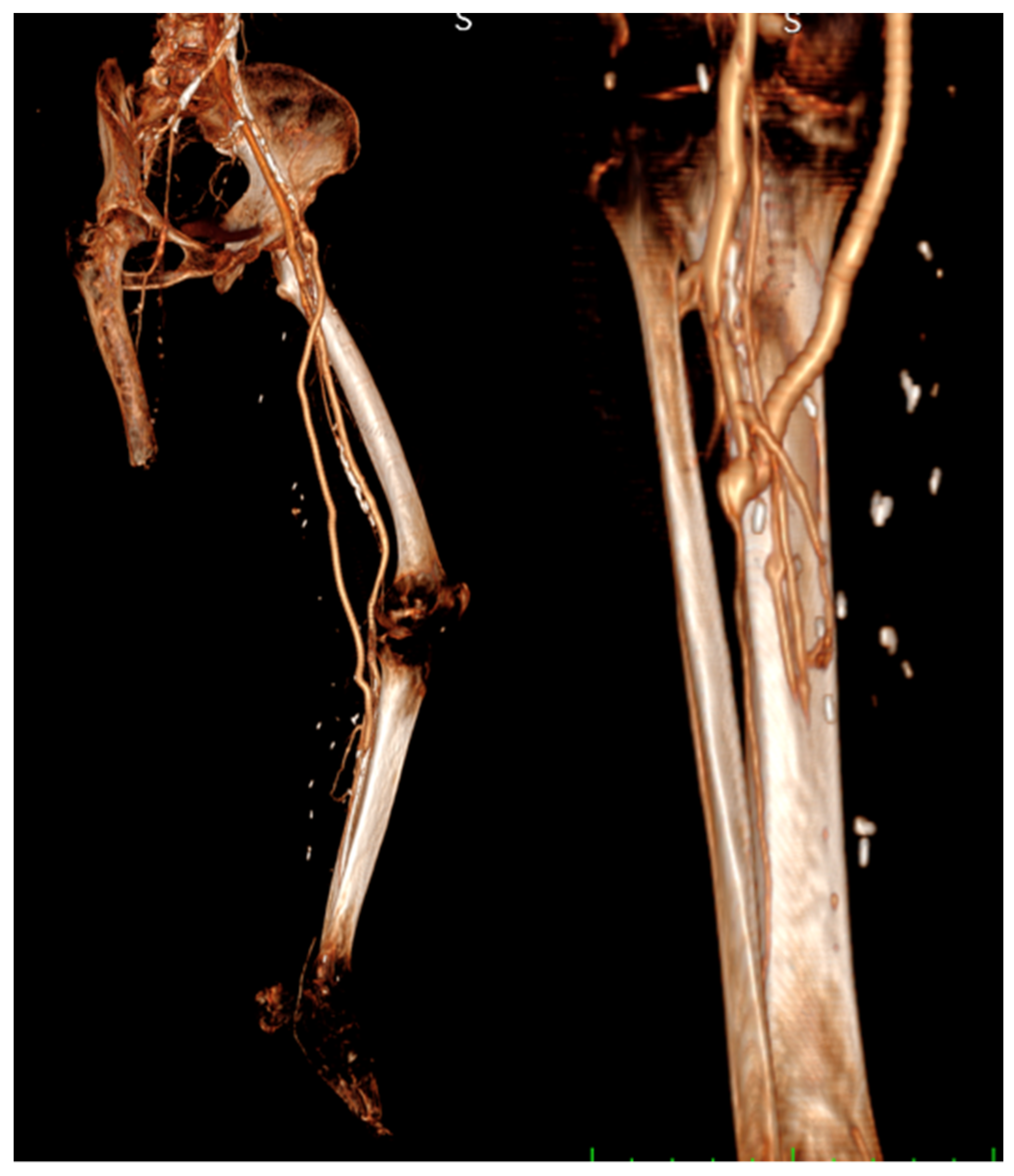 Diagnostics 13 01246 g003