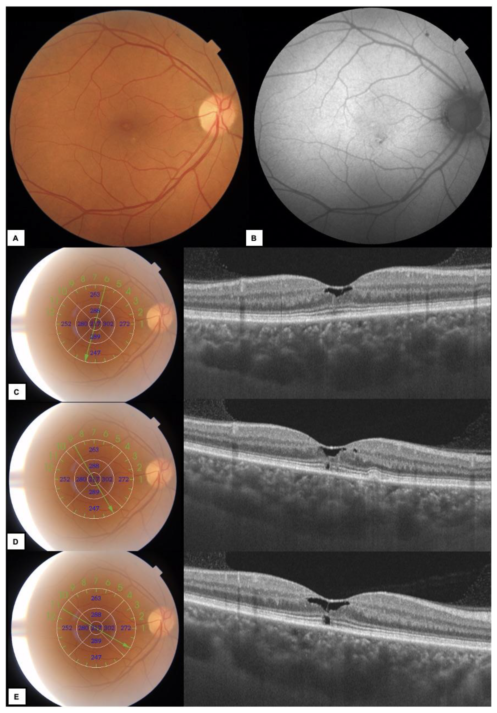 Diagnostics 13 01250 g001