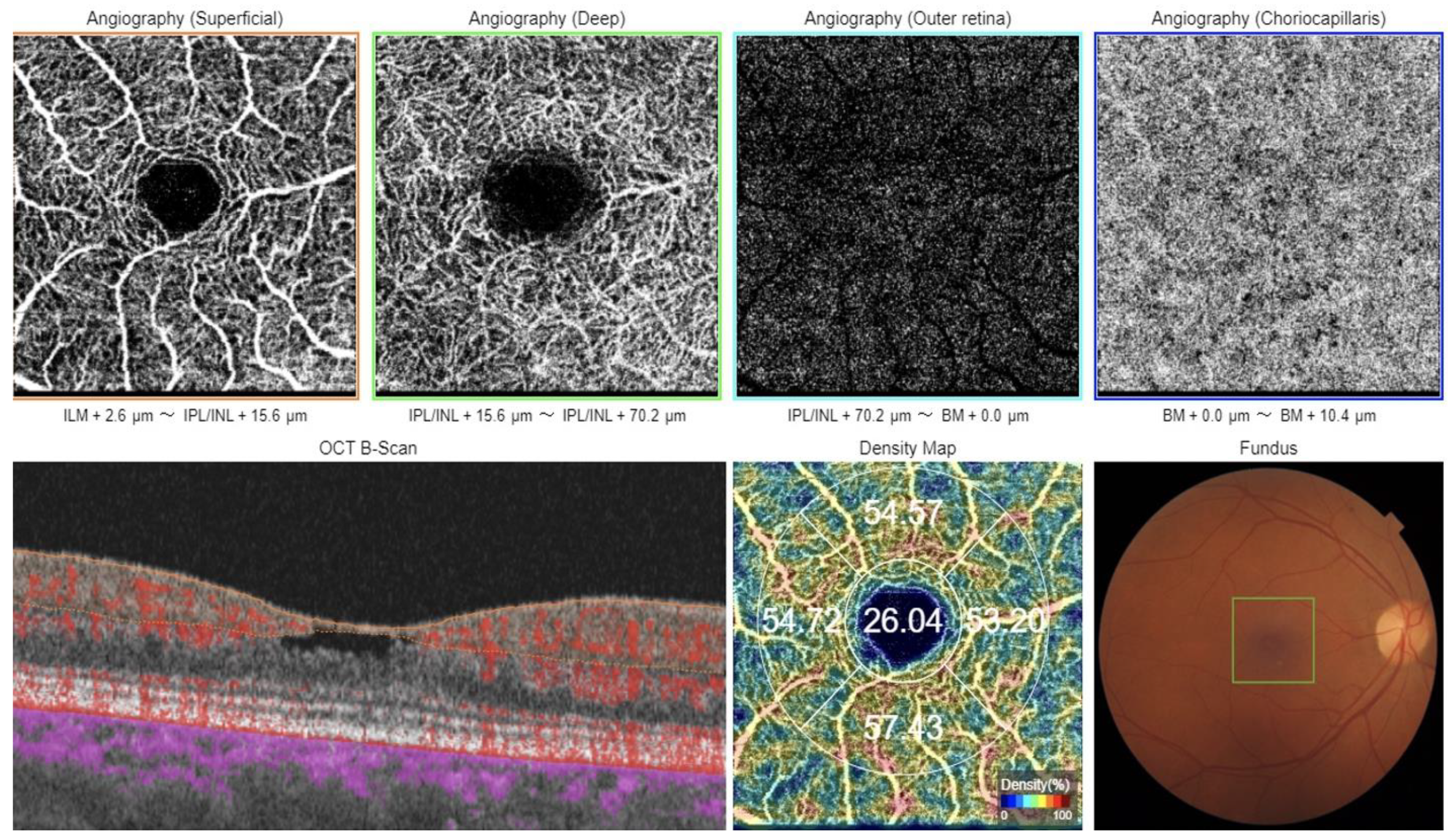 Diagnostics 13 01250 g002