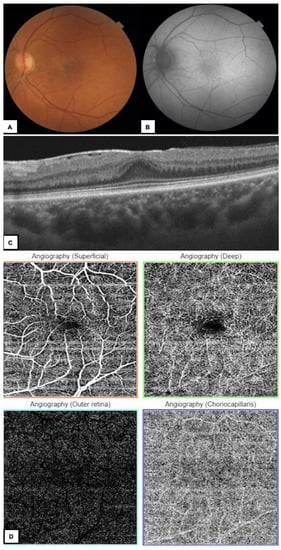 Diagnostics 13 01250 g003