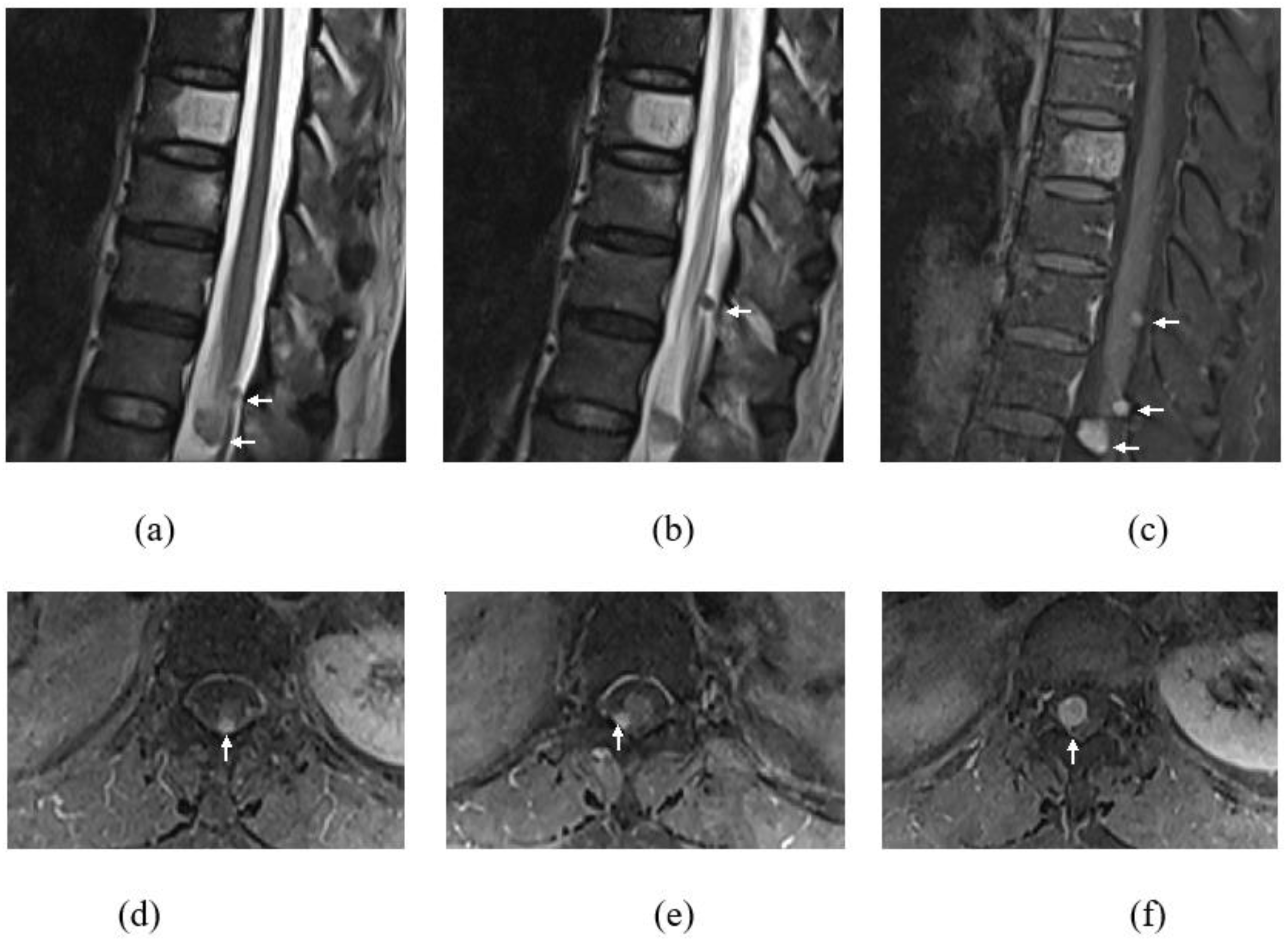 Diagnostics 13 01254 g001