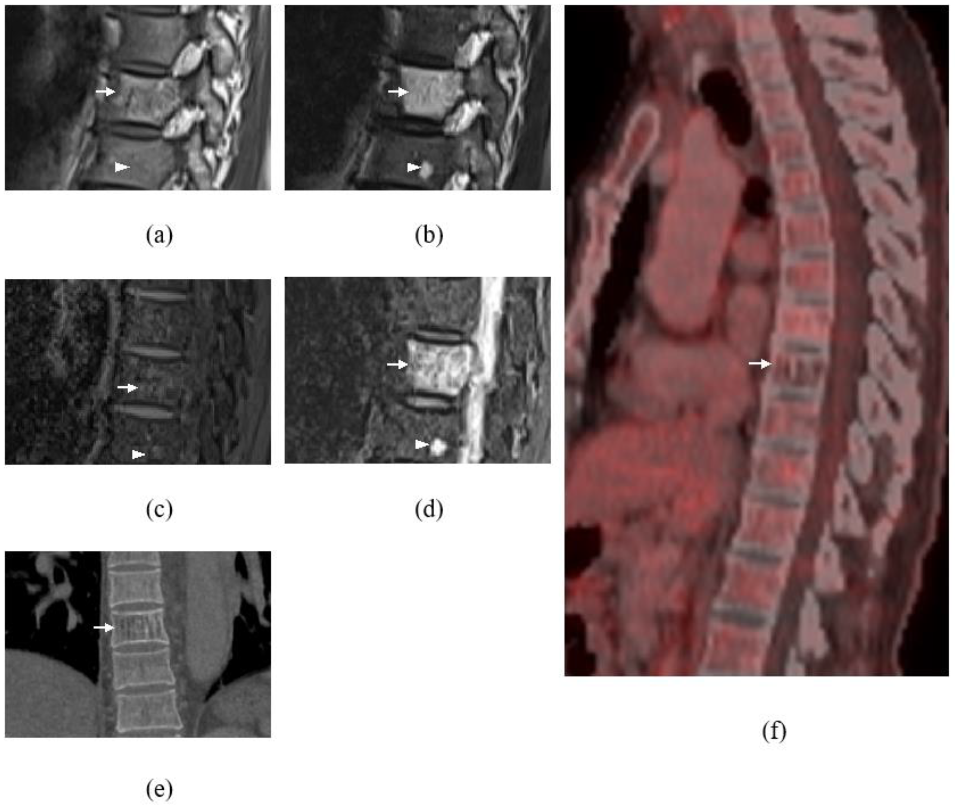Diagnostics 13 01254 g003